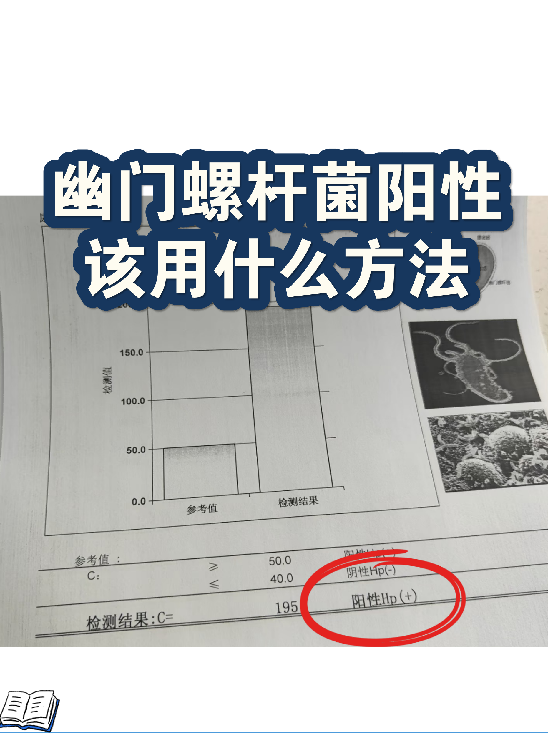  疫情的结果是什么(疫情有什么症状)