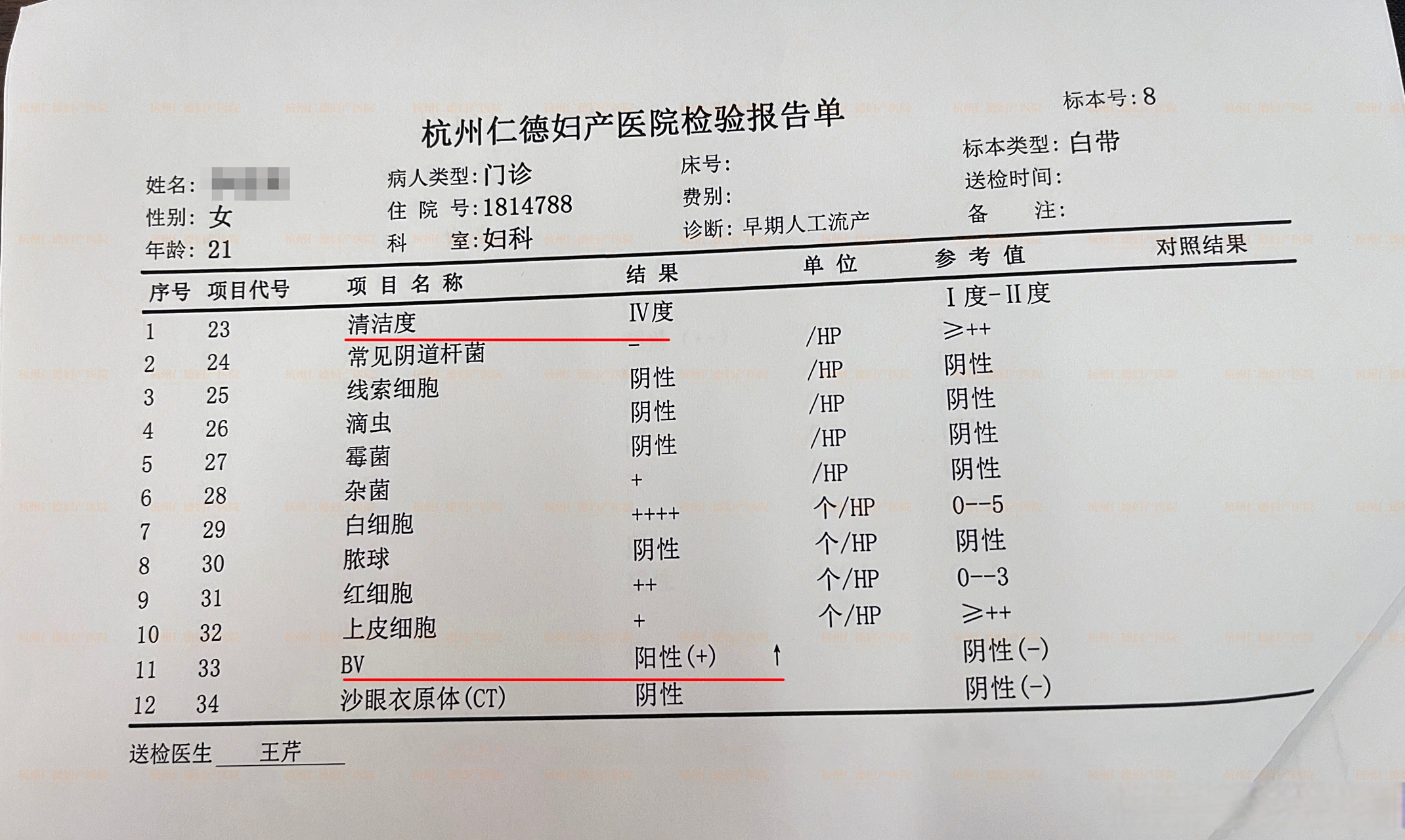 白带检查报告单分享: 【阴道清洁度Ⅳ度】表示存在严重阴道炎 【bv