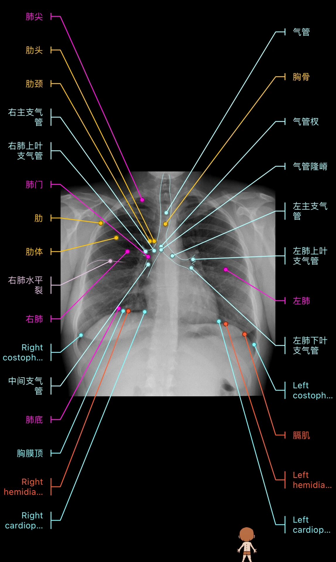 胸片部位图解图片