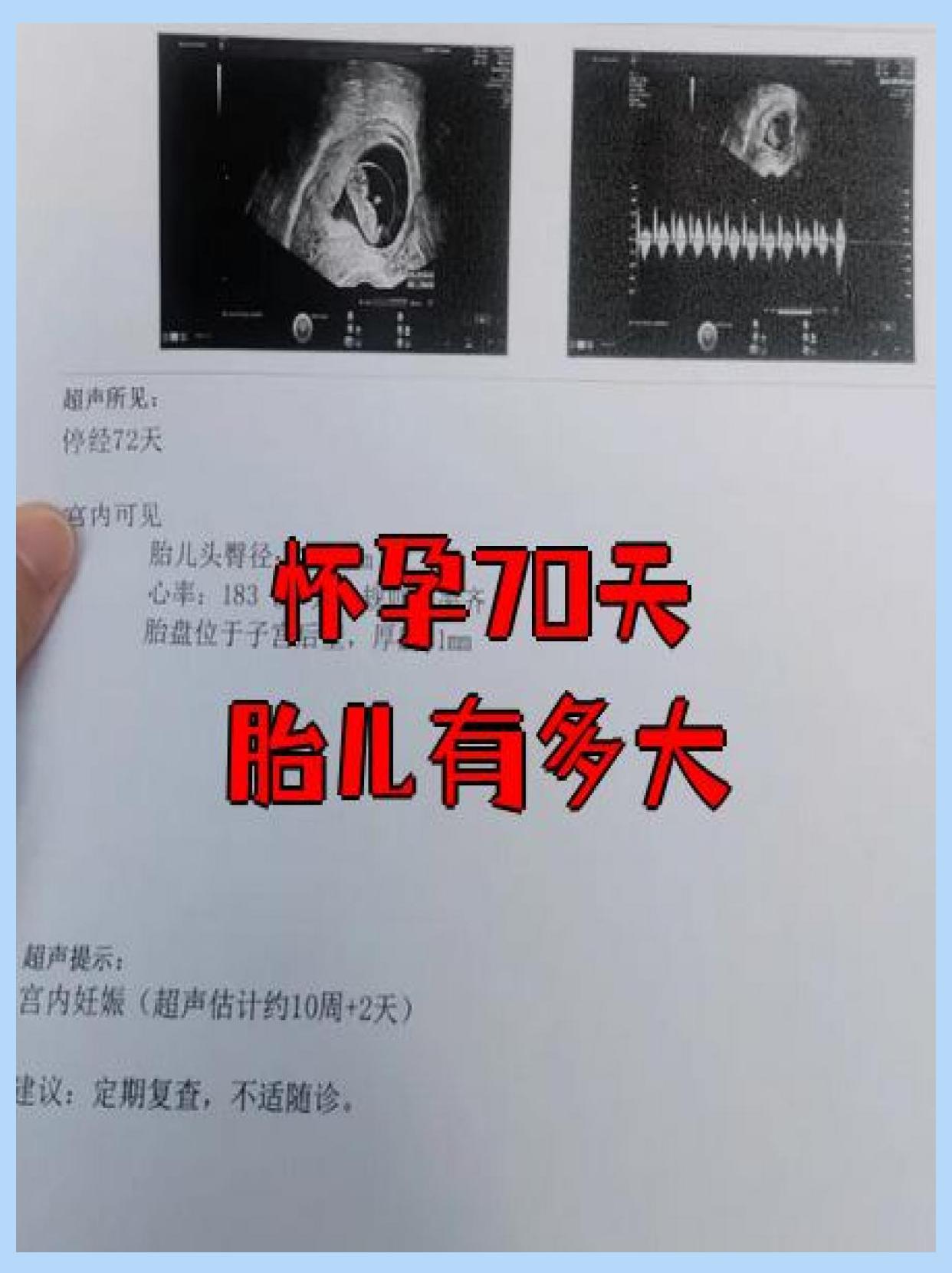 4厘米体重约4-5克像一颗小草莓