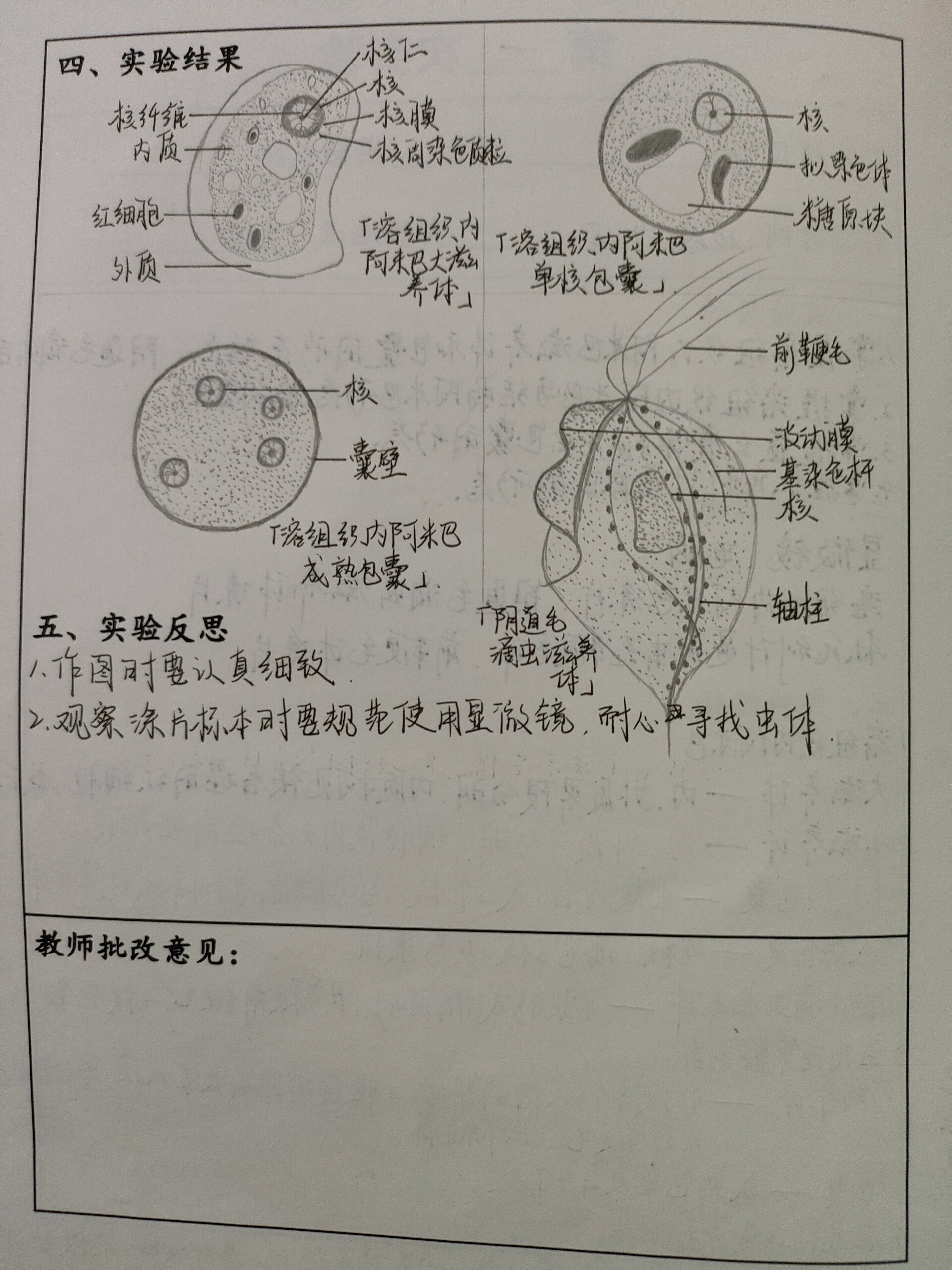 寄生虫学绘图阿米巴滋养体