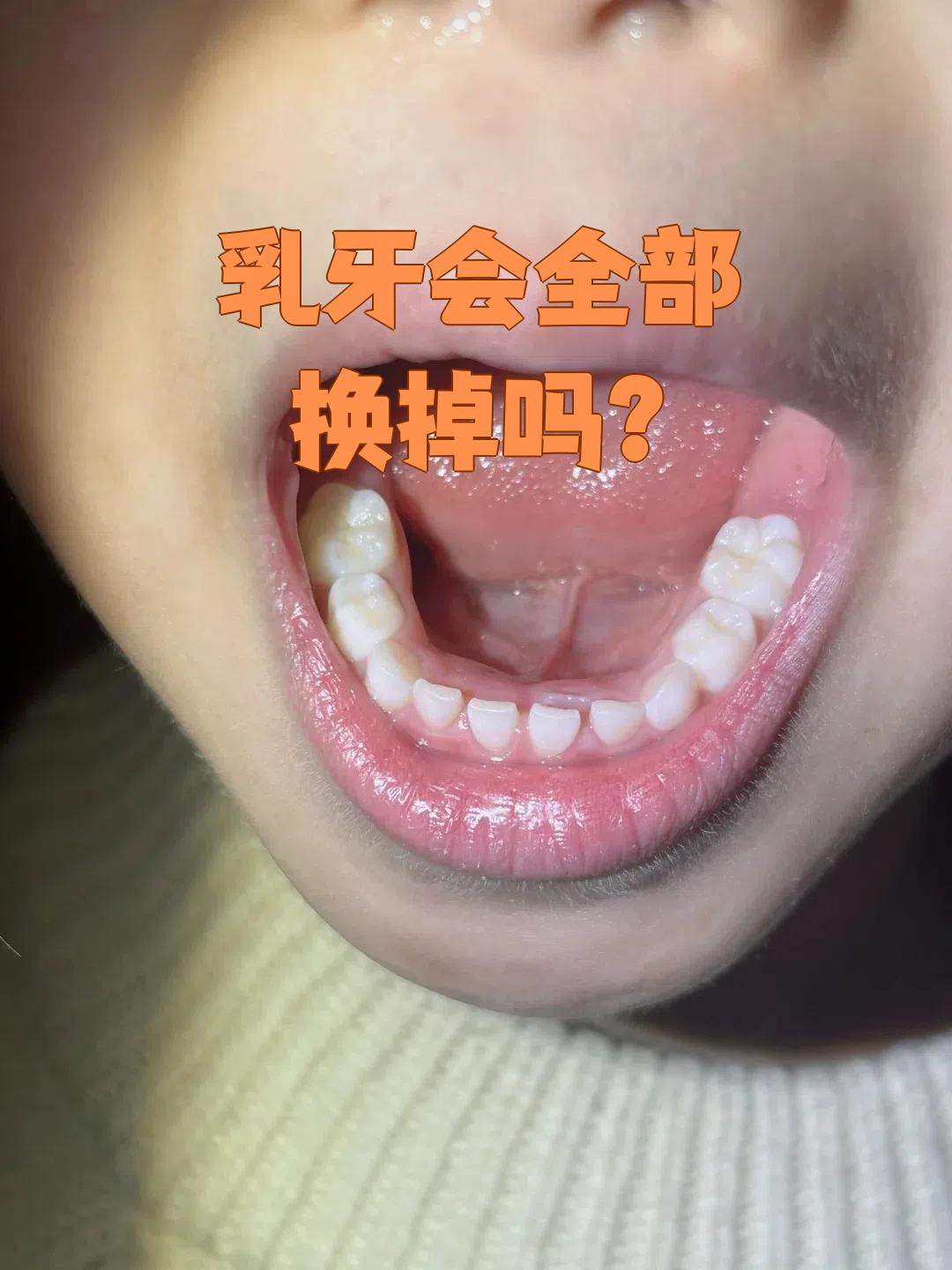 的是下颌乳中切牙,接着是乳侧切牙,乳尖牙,乳第一磨牙和乳第二磨牙