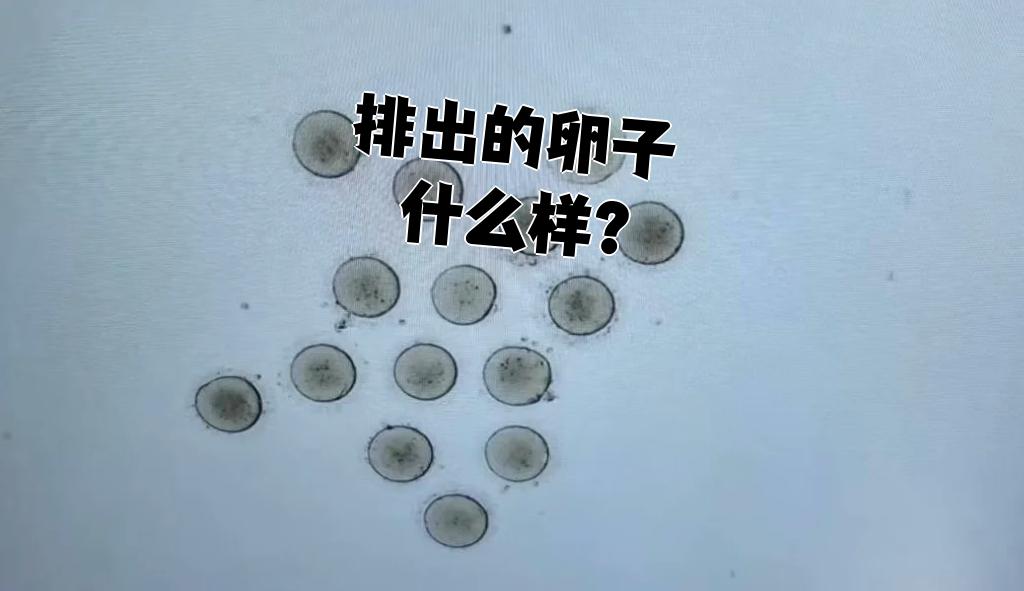 400个卵子会排出体外,每个月一般排出一个卵子