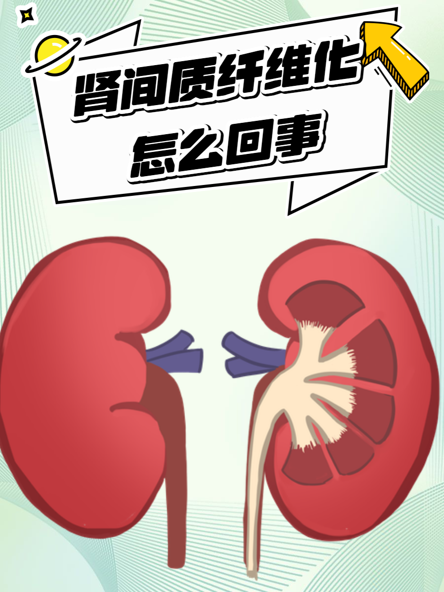 肾间质纤维化怎么回事?