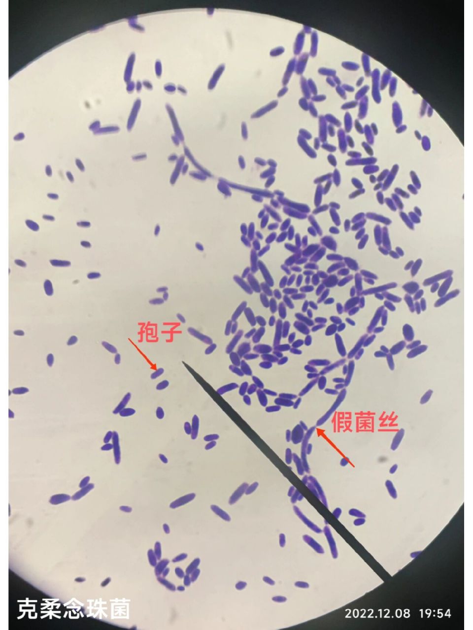 真菌孢子生殖图片