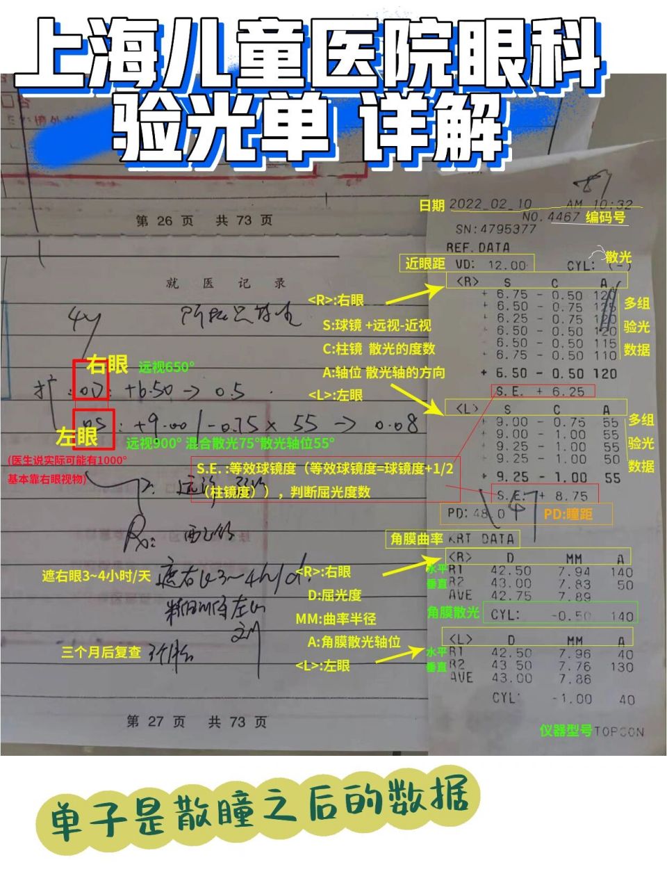 视力验光单图解|上海儿童医院 远视弱视斜视 💦图是我儿子在上海儿