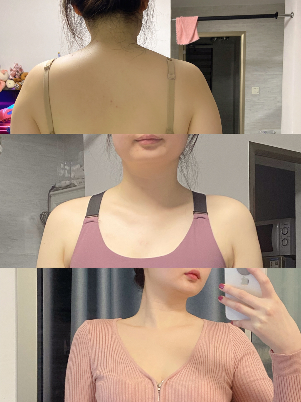 之前我的体态:厚背,圆肩,胸腔内扣,锁骨变形,斜方肌也比较厚 现在我