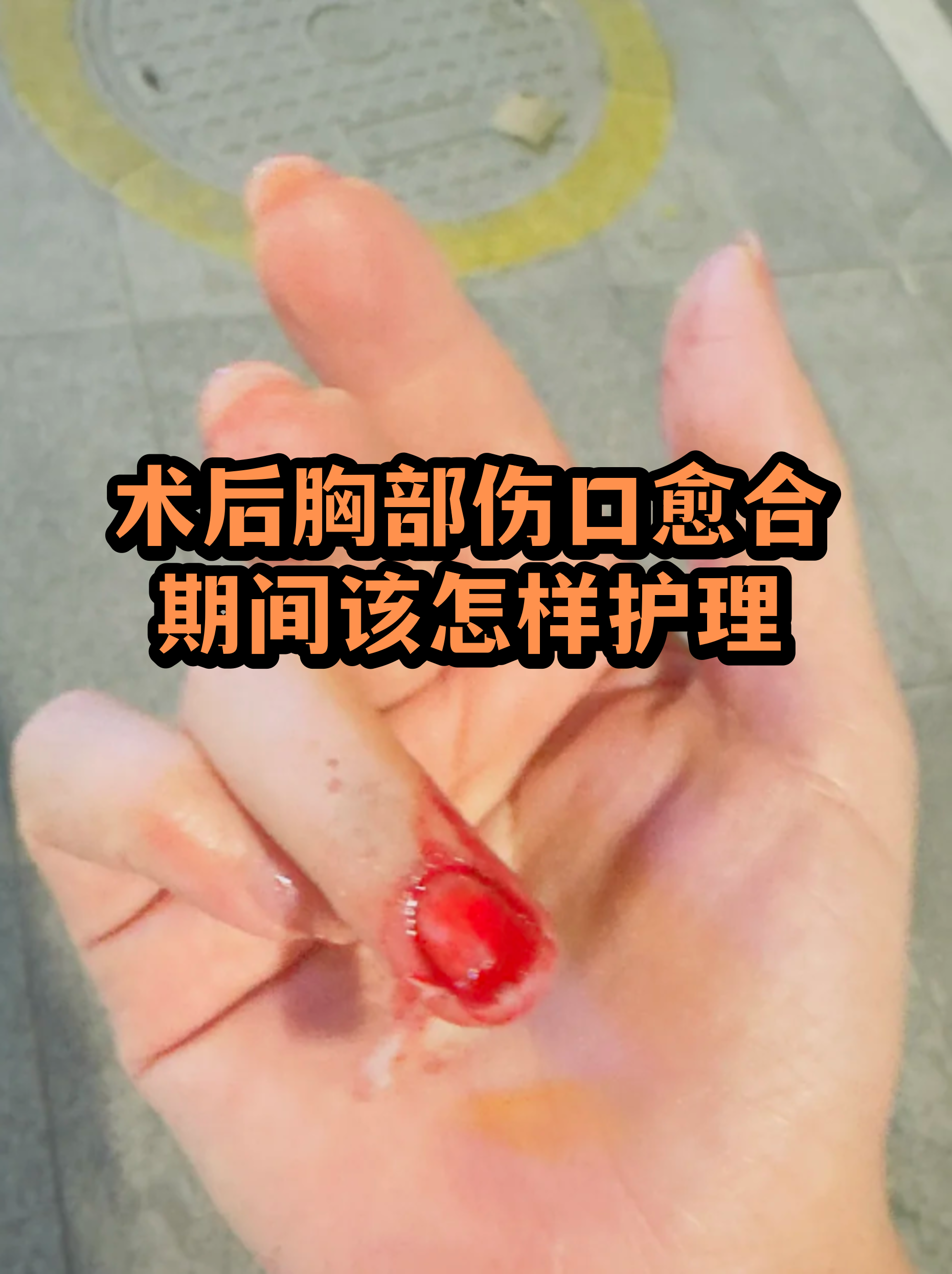 关于北京大学第三医院代取报告代挂号术后康复护理陪同,助力身体恢复的信息 关于北京大学第三医院代取报告代挂号术后康复护理陪同,助力身体恢复的信息
