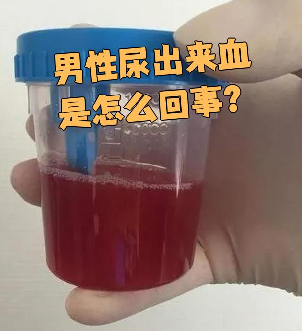 为什么拉的尿是红色的