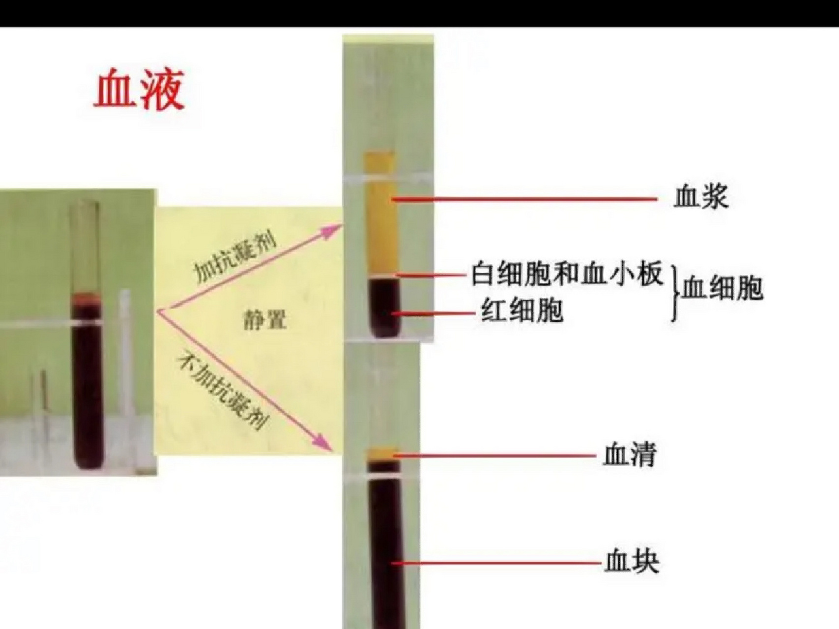 全血,血浆,血清的区别 全血包括血细胞和血浆的所有成分.