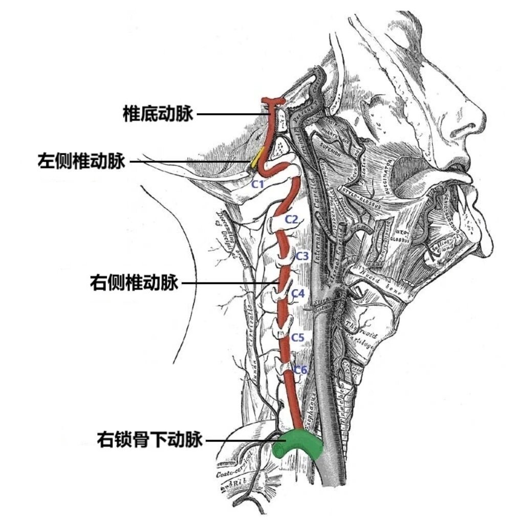 椎动脉开口图片