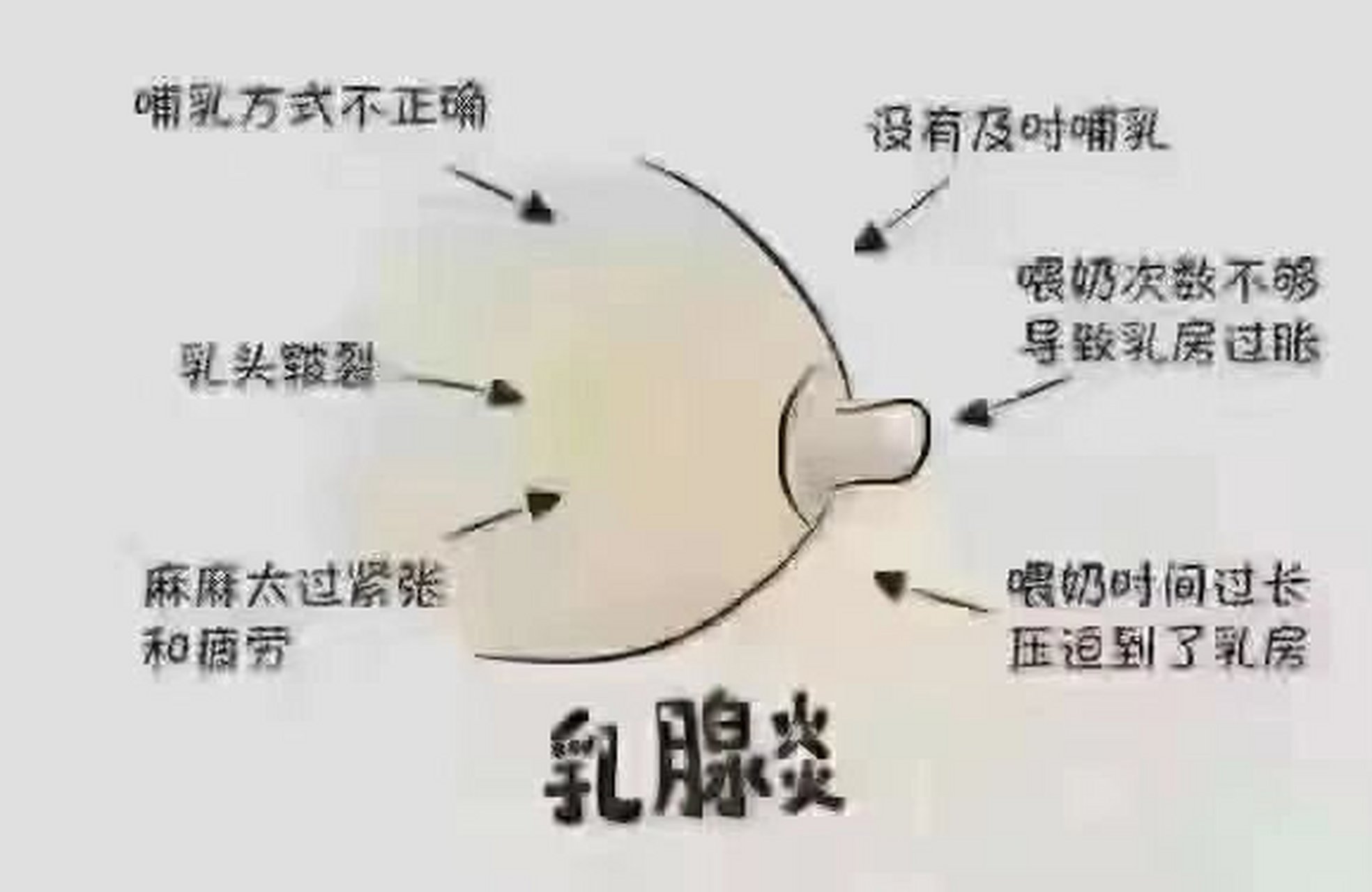 乳头皱巴巴是什么原因图片