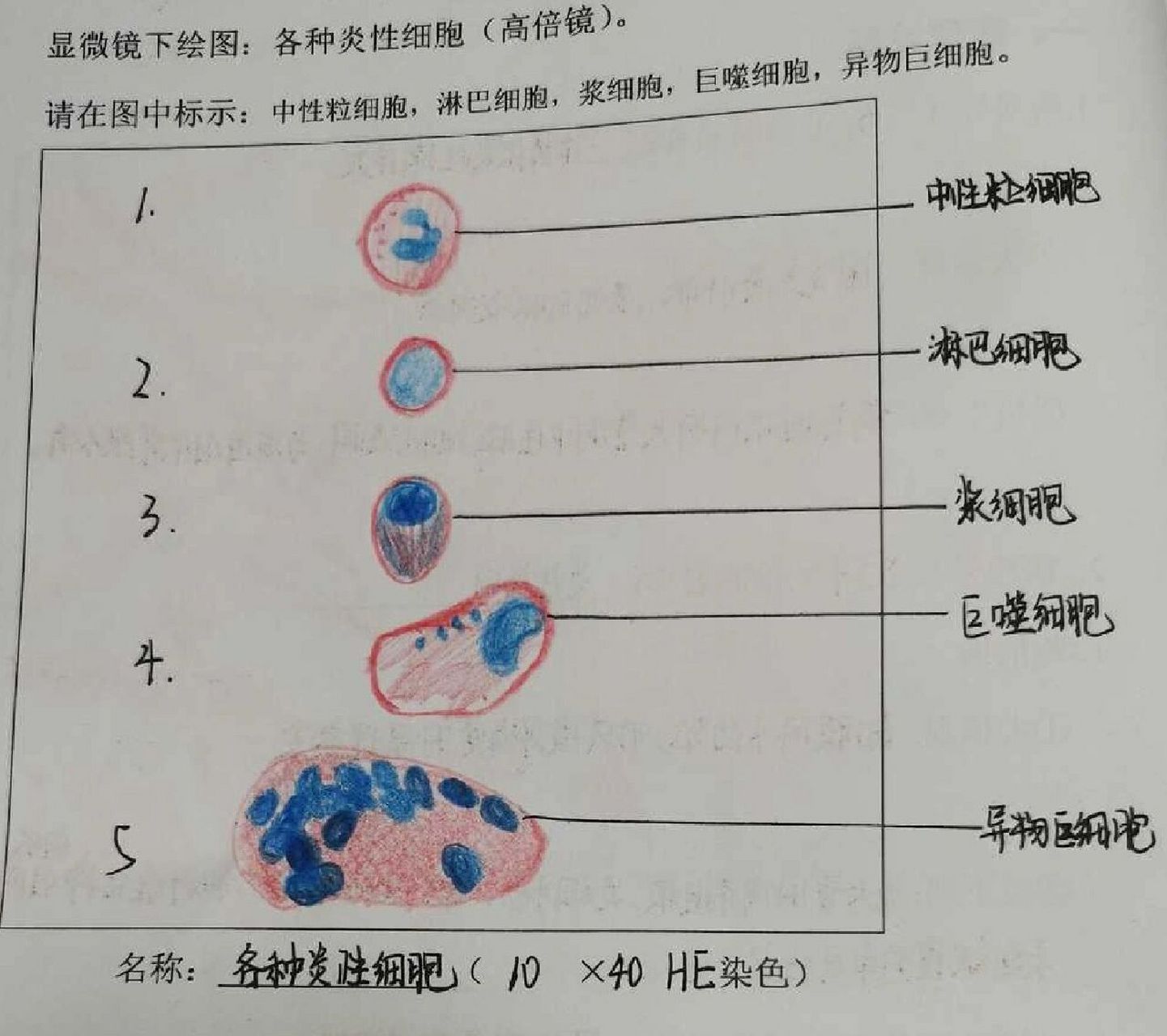 假小叶实验报告手绘图图片