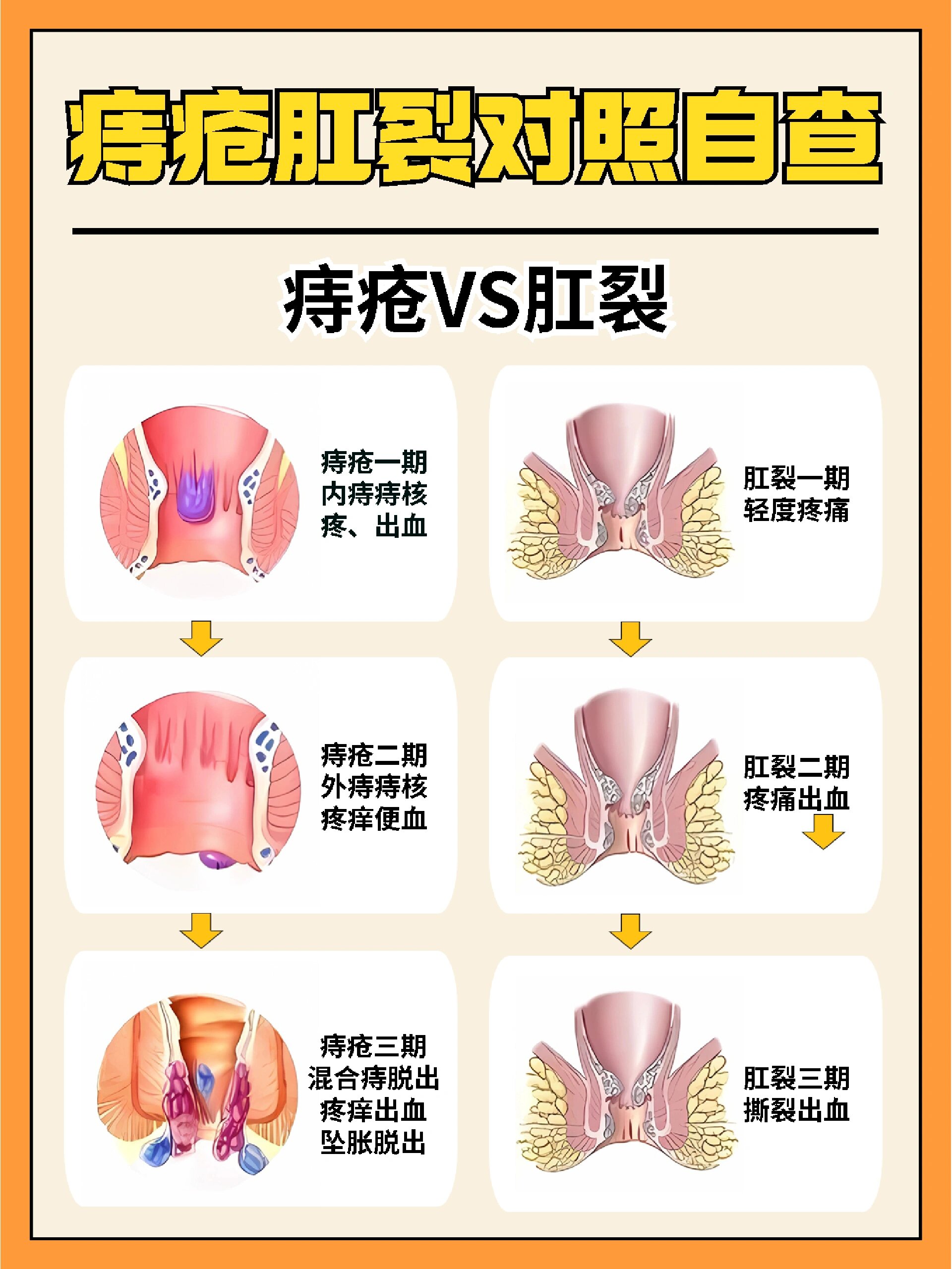 外痔的肉球照片图片