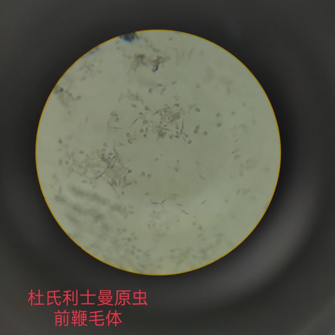 医学原虫镜下观察 ①溶组织内阿米巴包囊 (感染期为四核包囊,二分裂)