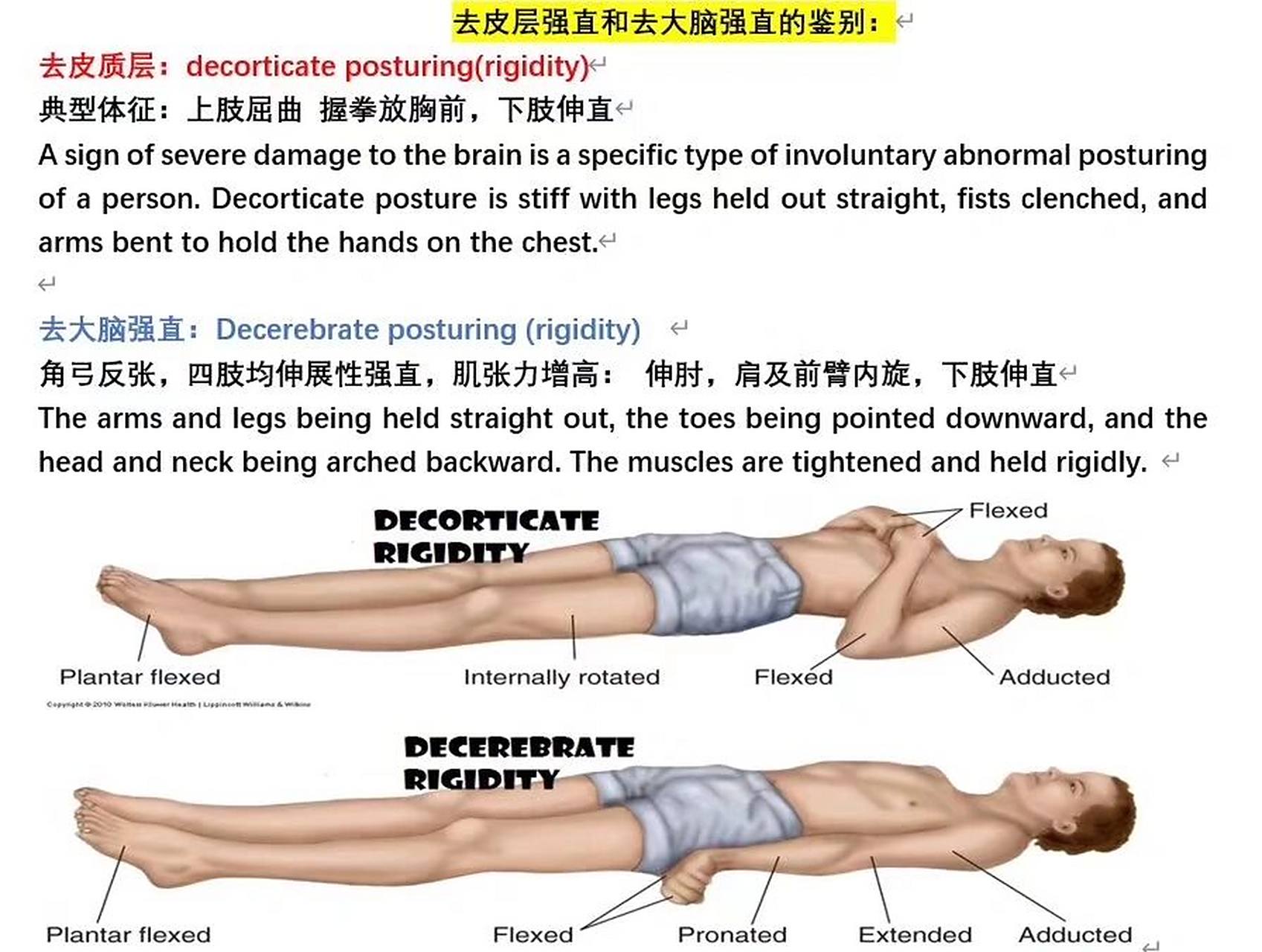 看谁还在傻傻的分不清 去皮层和去大脑强直