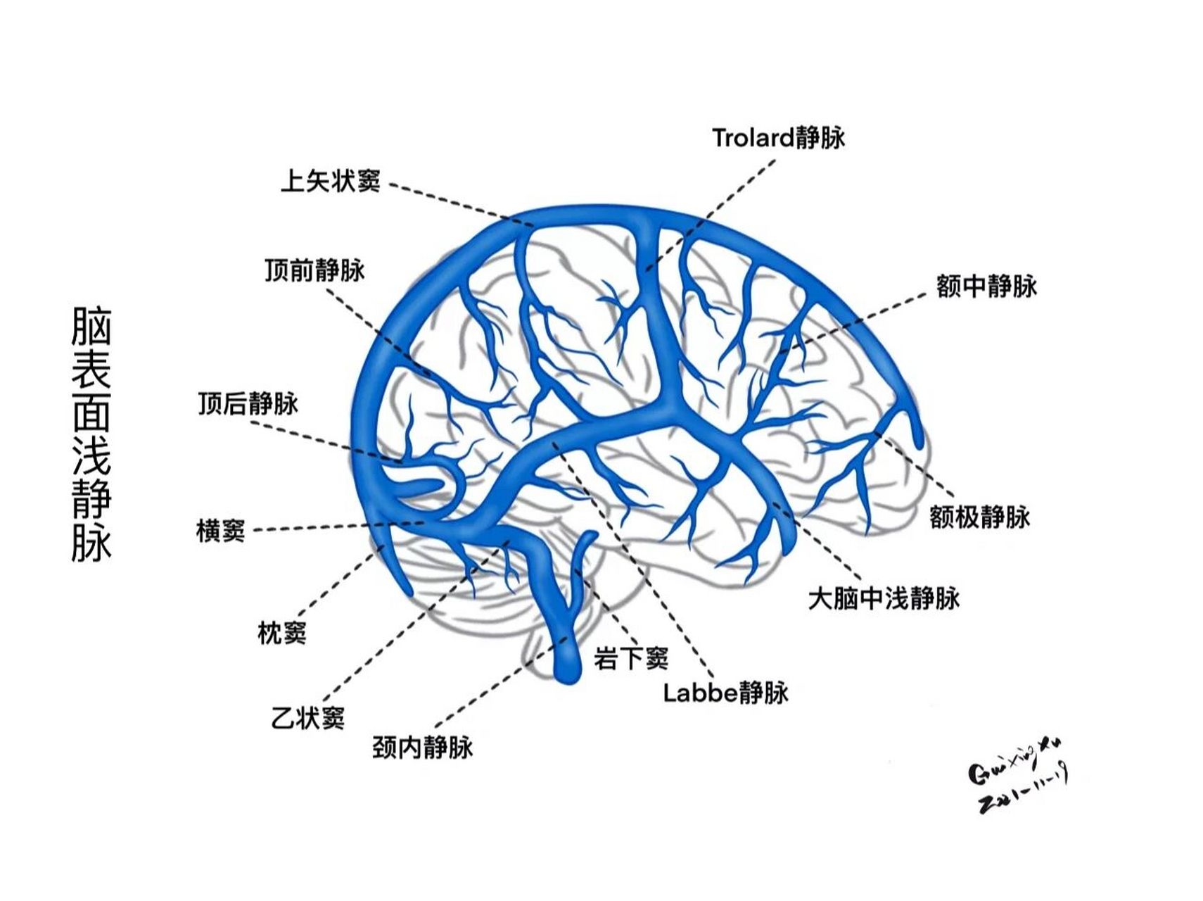 大脑动脉3D解剖图血管图片