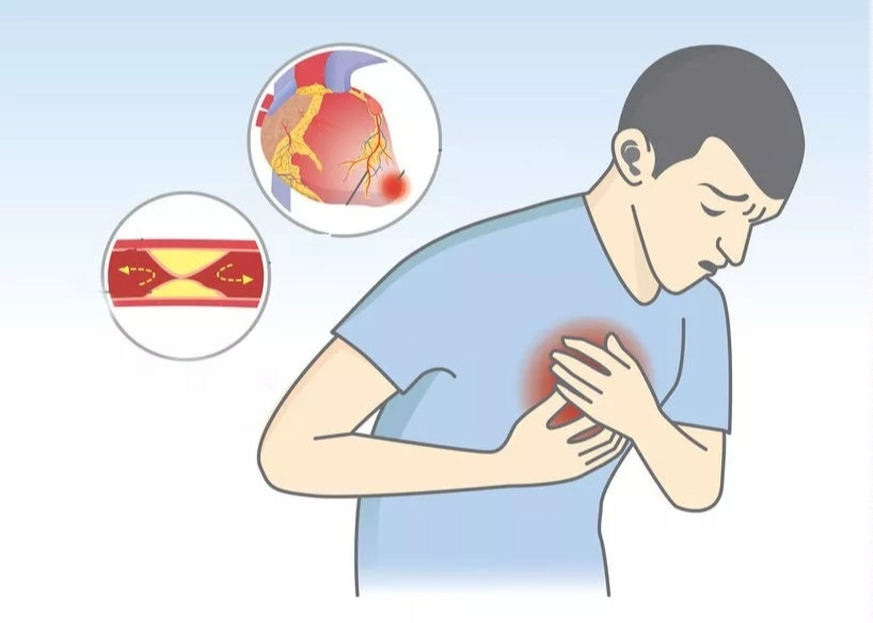 识别心绞痛急救药 如何识别胸痛,有可能是心梗前兆呢?
