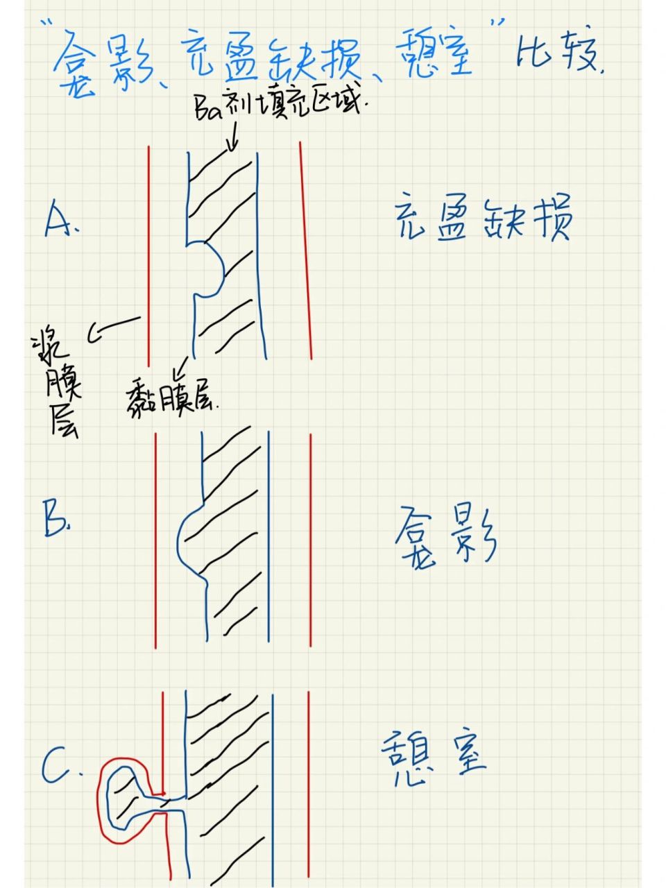 只有医学生才能看懂的图(龛影,充盈缺损,憩 只有医学生才能看懂的图