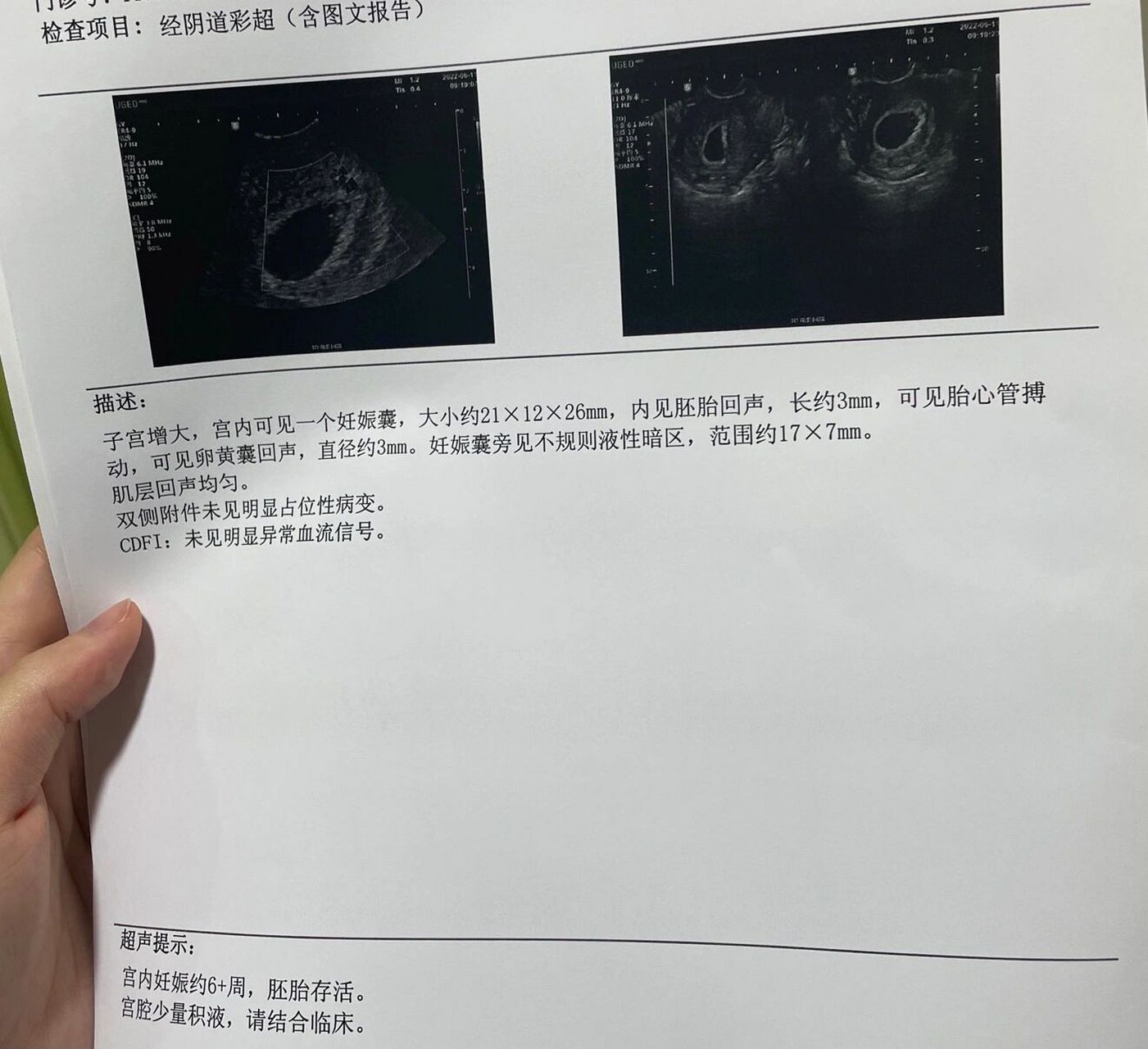 6周 ,看到孕囊和胎心了 5周5天第一次去医院时,hcg一万多,阴超还看不