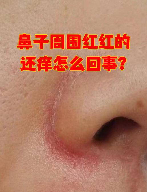 为什么鼻子会痒