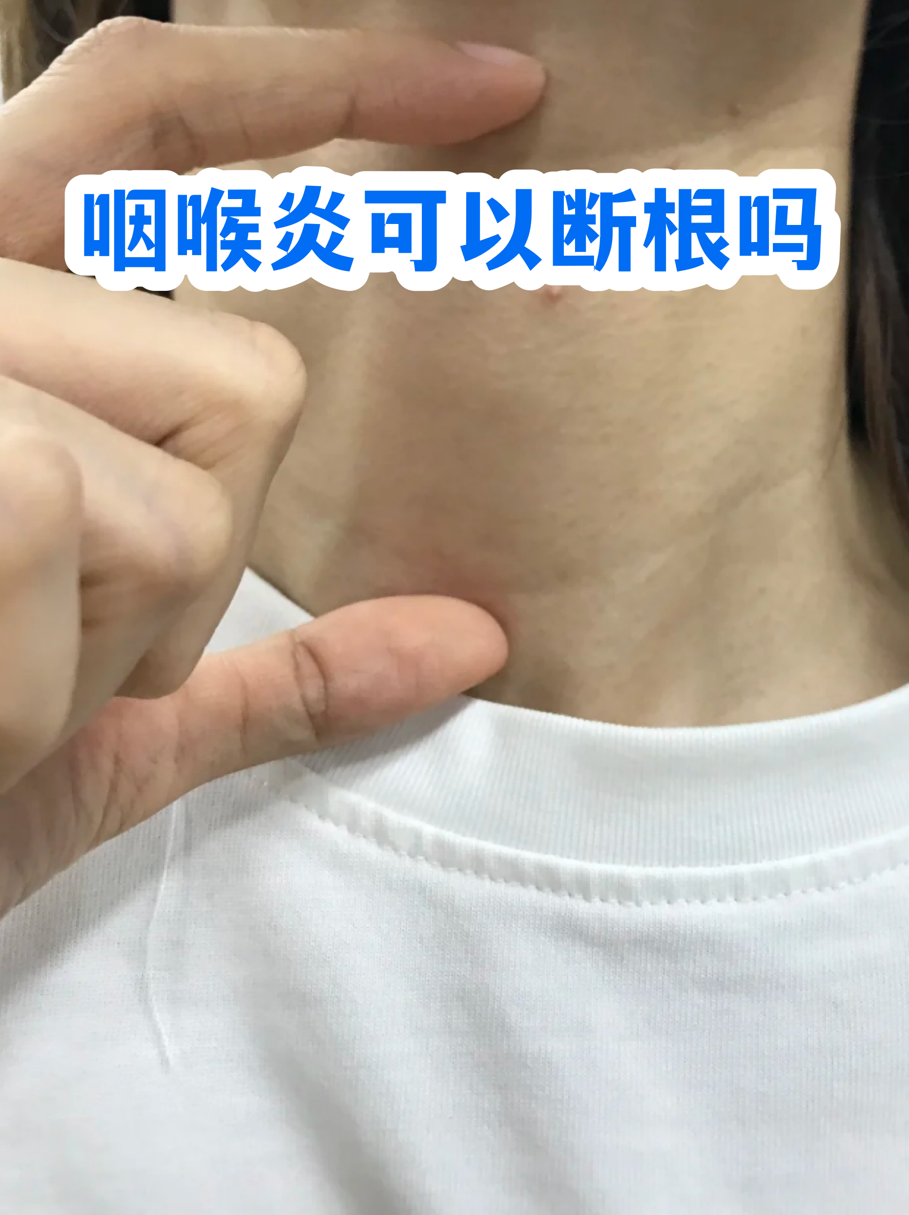  病毒引起的嗓子发炎怎么治疗好(病毒引起喉咙痛有什么症状)