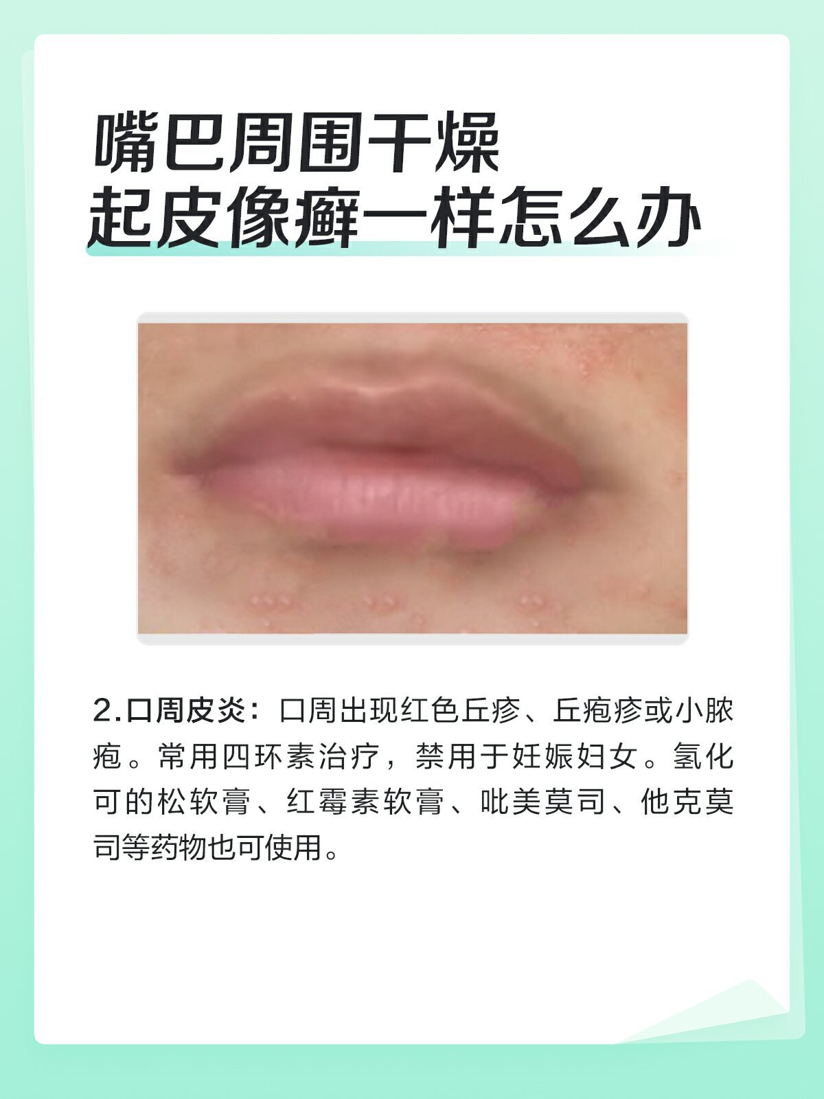 可能与口周湿疹,口周皮炎有关,需要根据具体病因治疗,以药物治疗为主