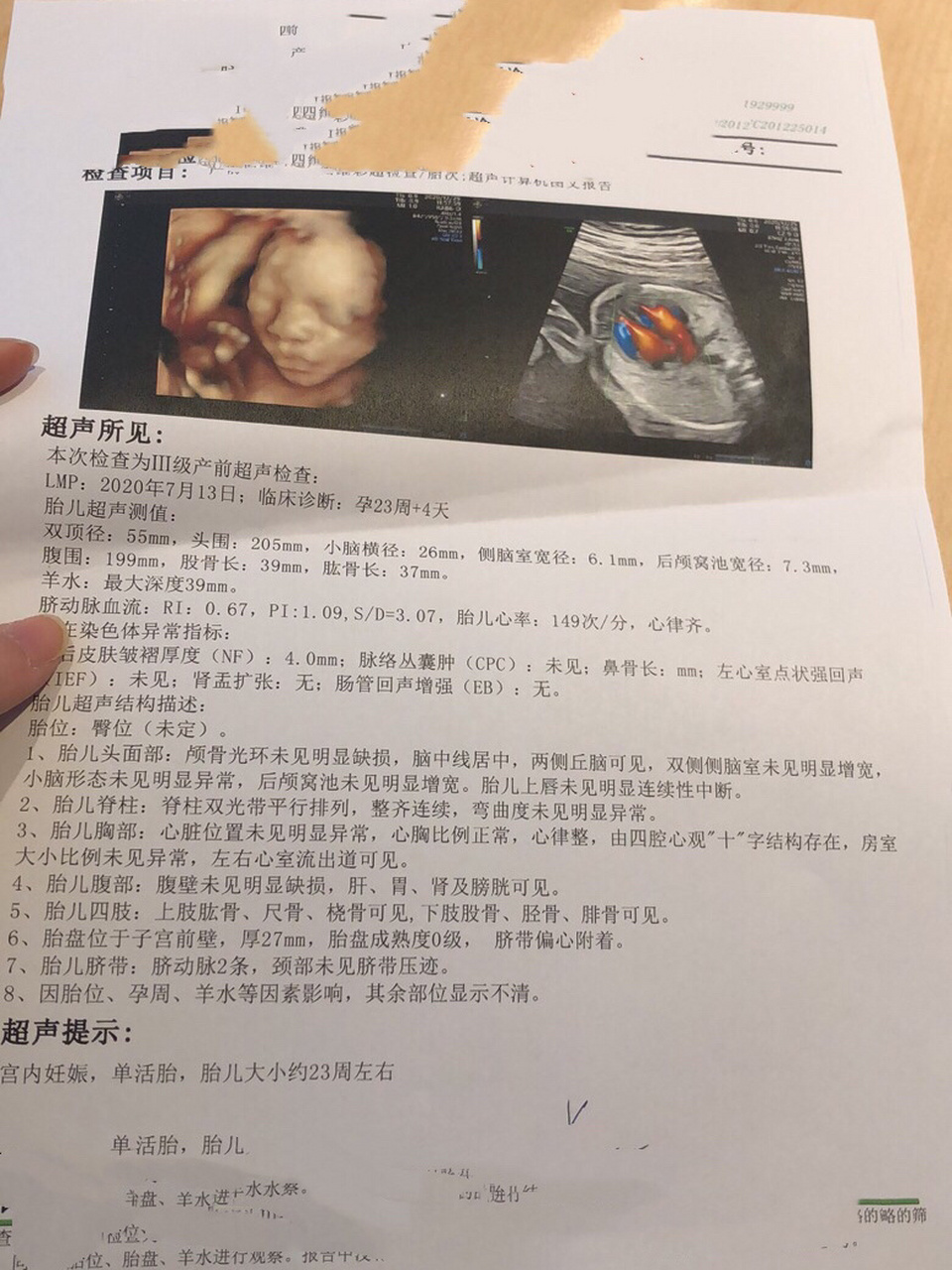 四维怎么看男女 四维报告出来了 帮忙看看是男是女哦