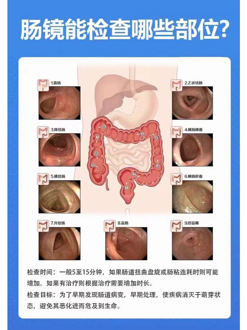 肠镜结构图图片