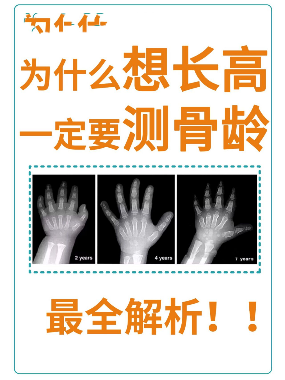 其实定期检测骨龄,可以, 	 判断发育情况:反映孩子的真正发育水平