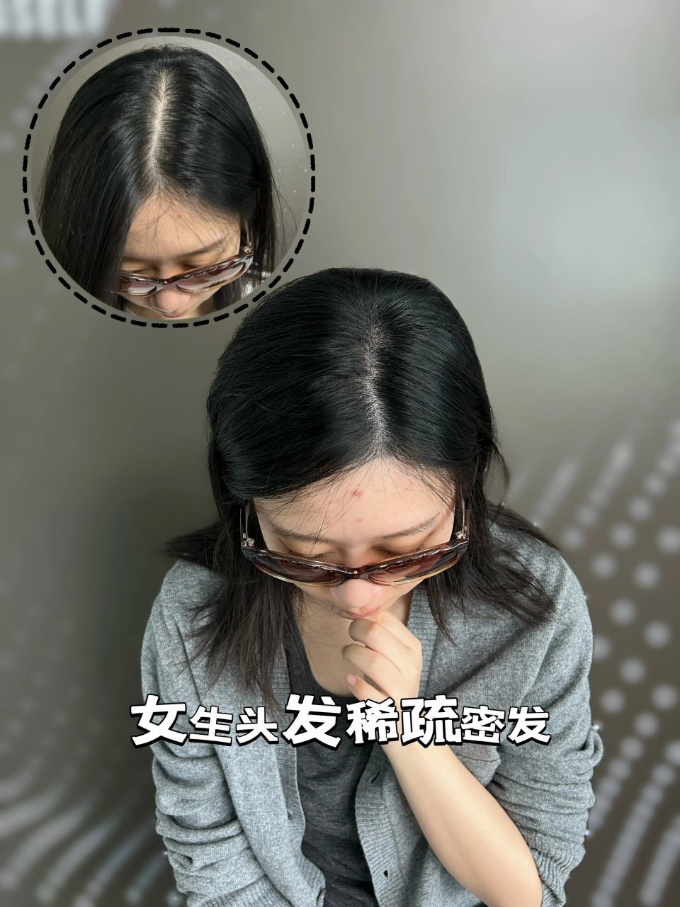 女性脱发留什么发型图片