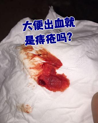 很多人以为大便出血就是痔疮,其实不一定