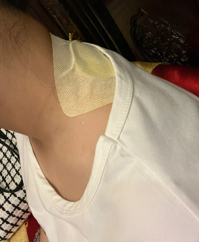 睡觉时扭到脖子,一动就疼得厉害?