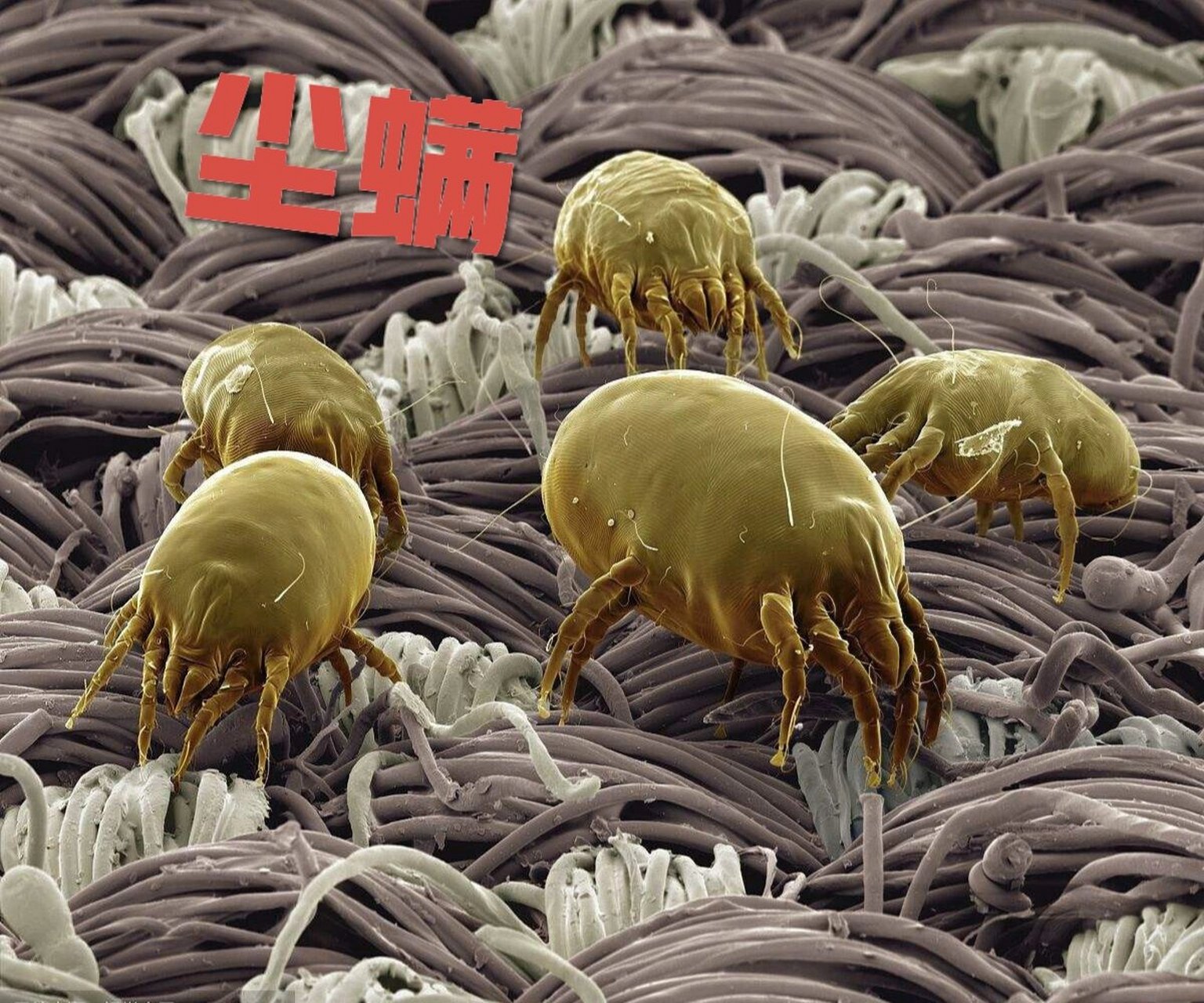 图一:蠕形螨91,又称毛囊虫,毛囊螨,寄生于多种哺乳动物,包括人的