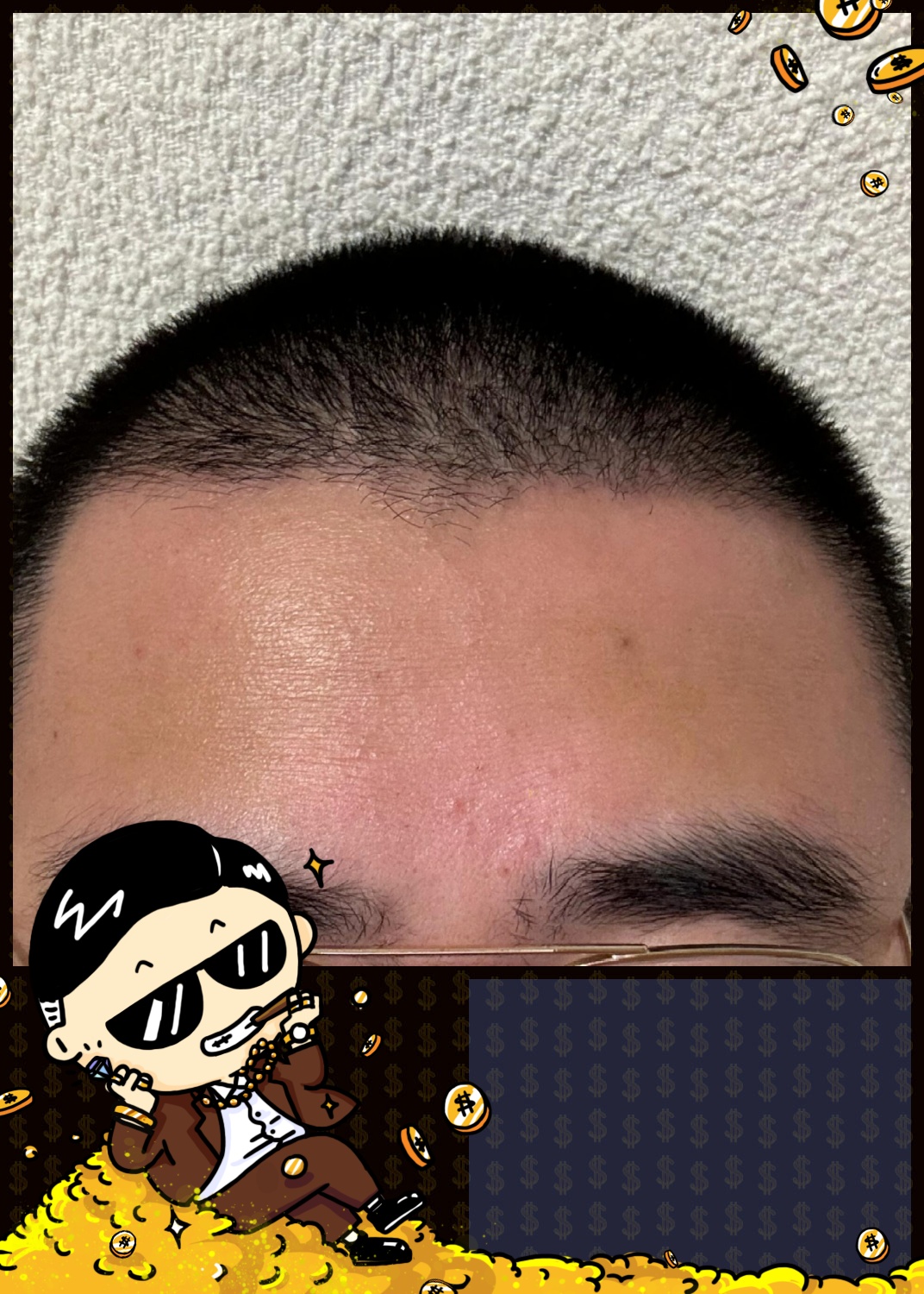 救命啊家人们印堂发黑是不是要倒霉了?有木有懂的大佬告诉我一下啊!