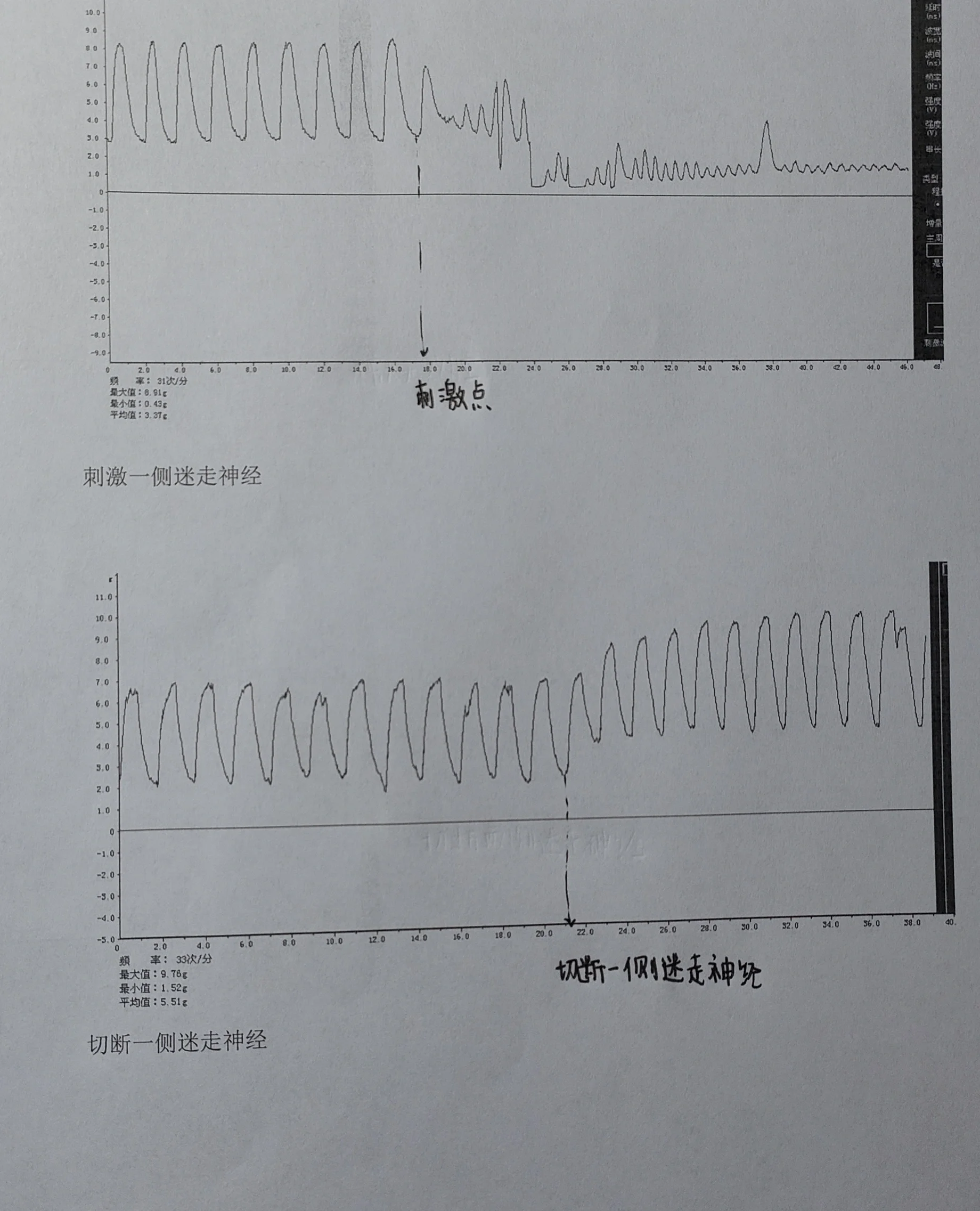 家兔正常血压曲线图图片