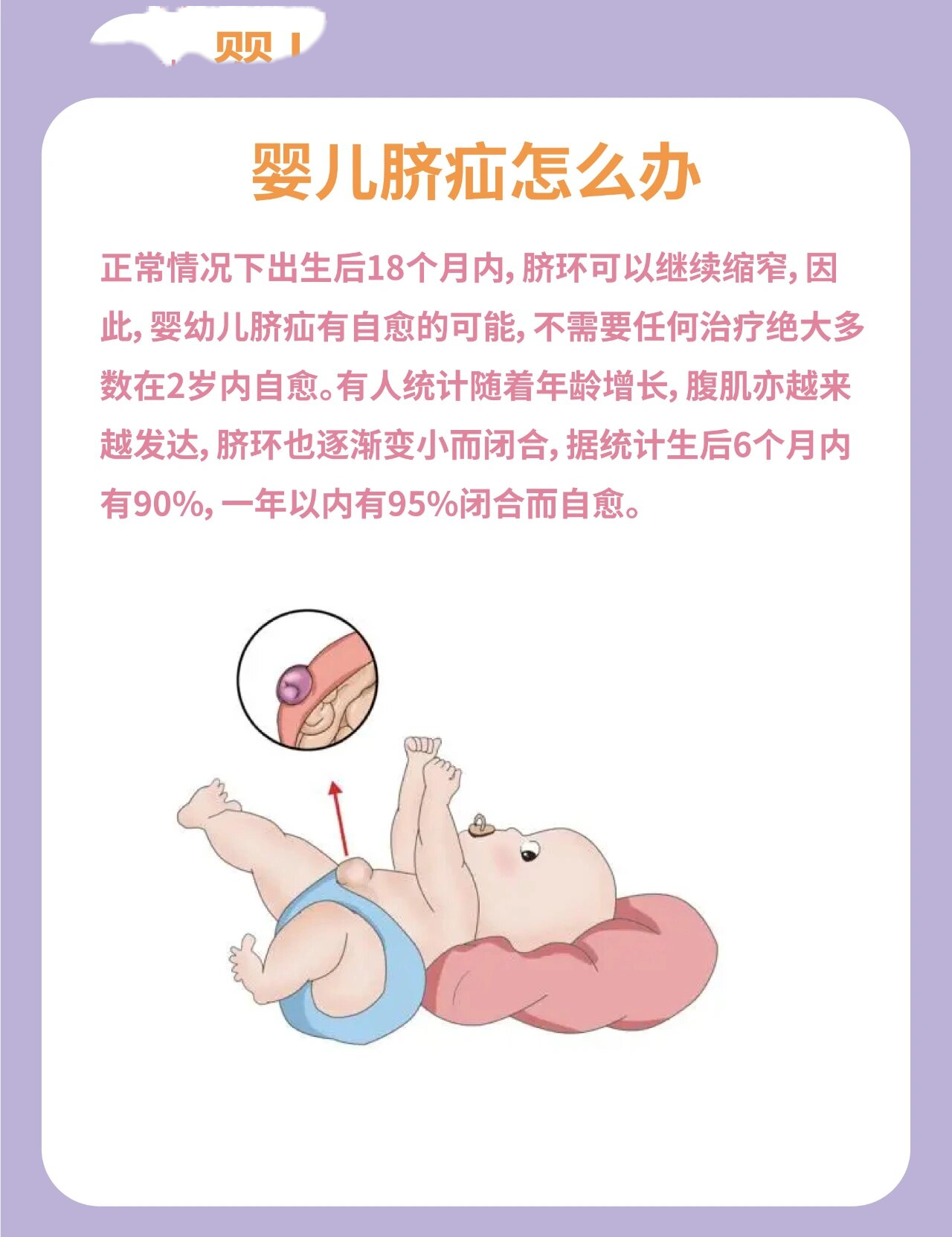 婴儿肚脐脱落过程图解图片