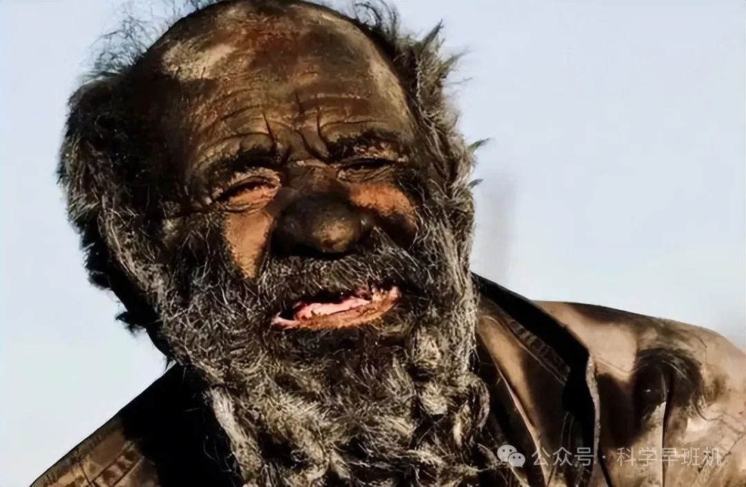 阿穆·哈吉,这位以不洗澡闻名的伊朗老人,竟然在长达67年的时间里从未