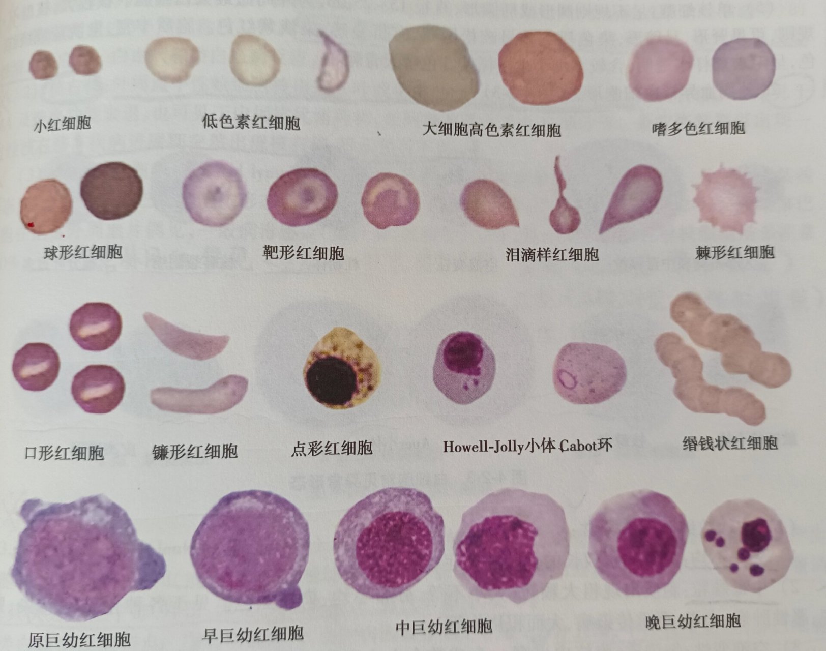 常见红细胞异常形态