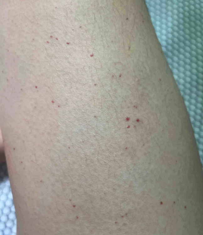 不同情况需要不同处理: