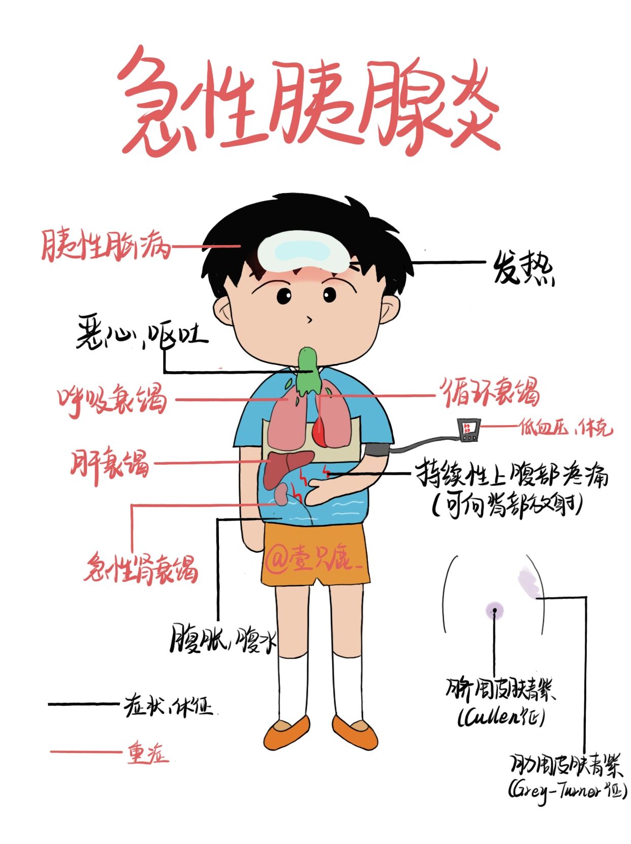 胰腺炎反射区的位置图图片