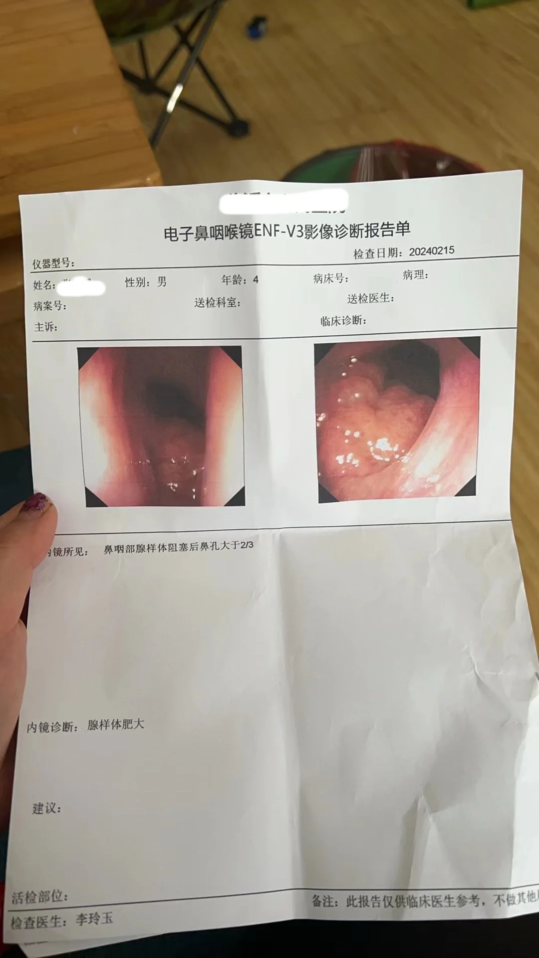 4岁小朋友腺样体肥大