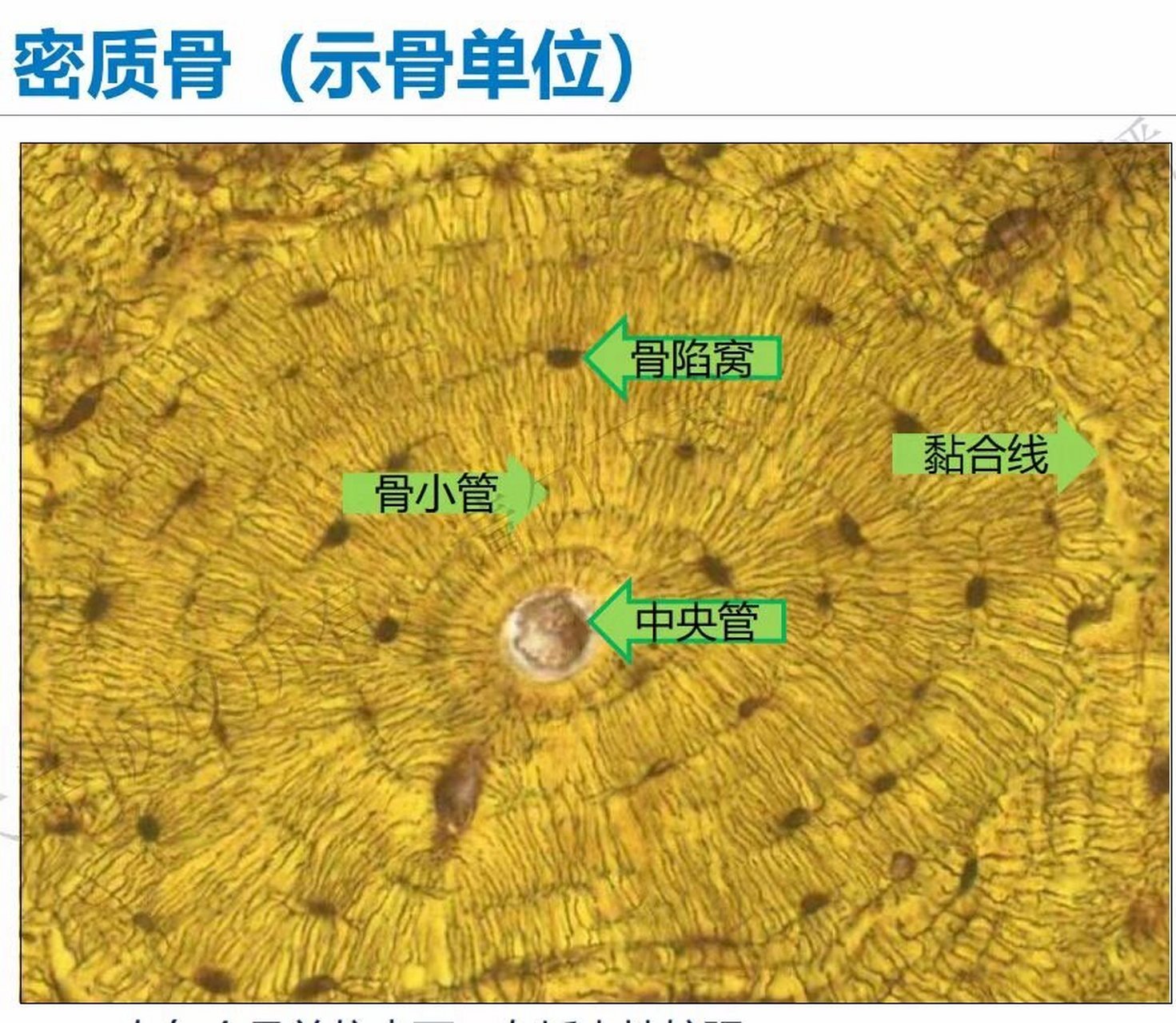 骨穿涂片示意图图片