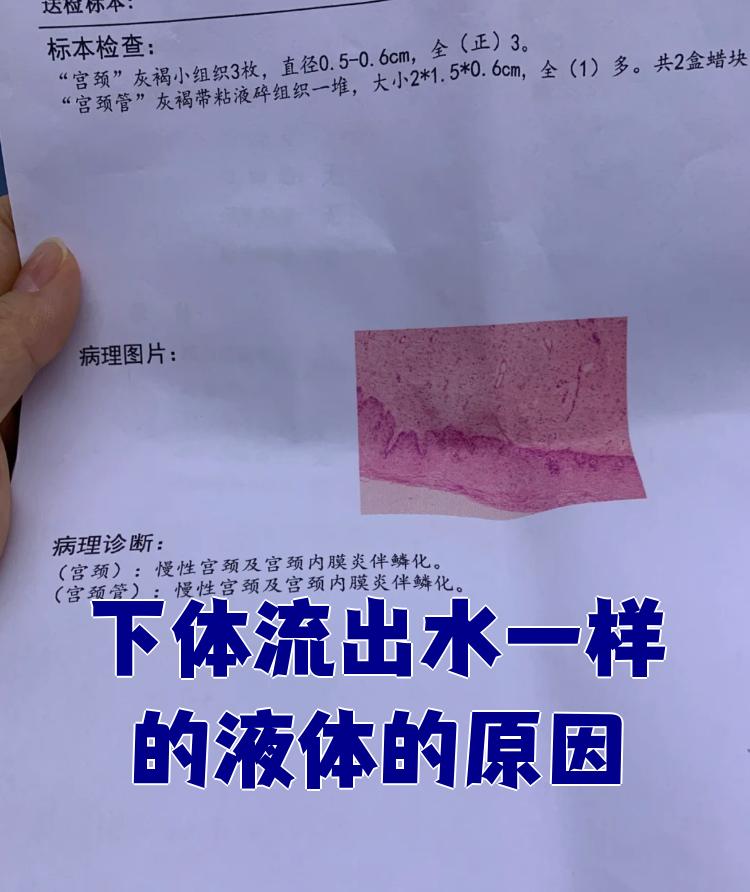 为什么下面会流水