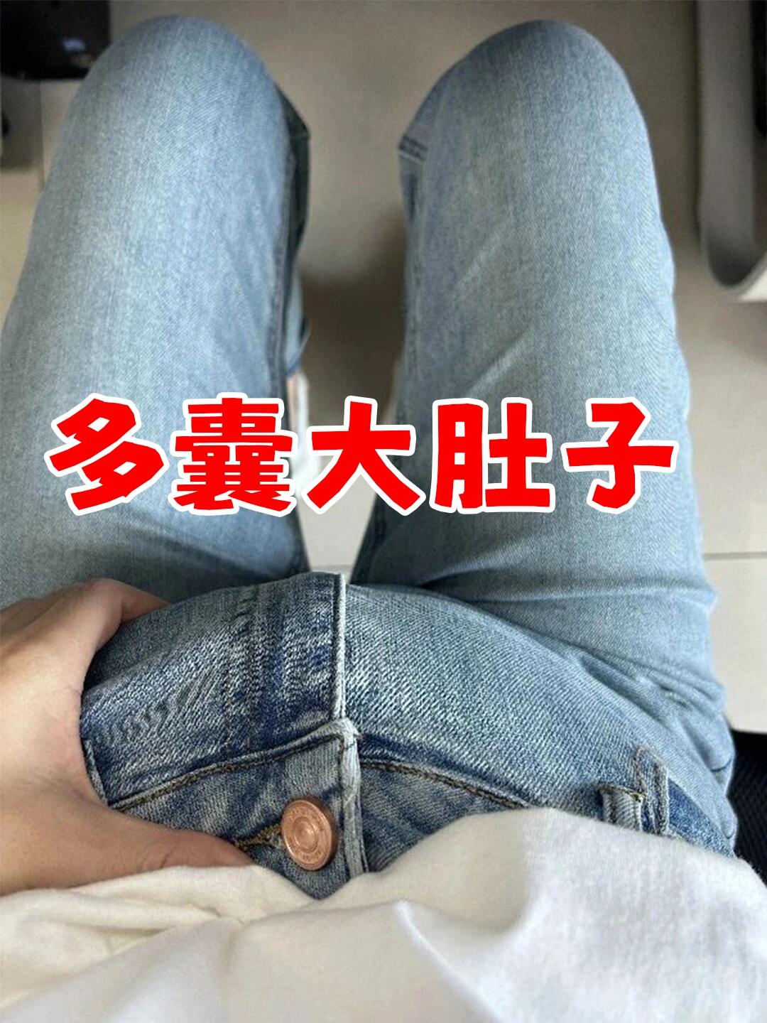 卵巢囊肿肚子变大照片图片