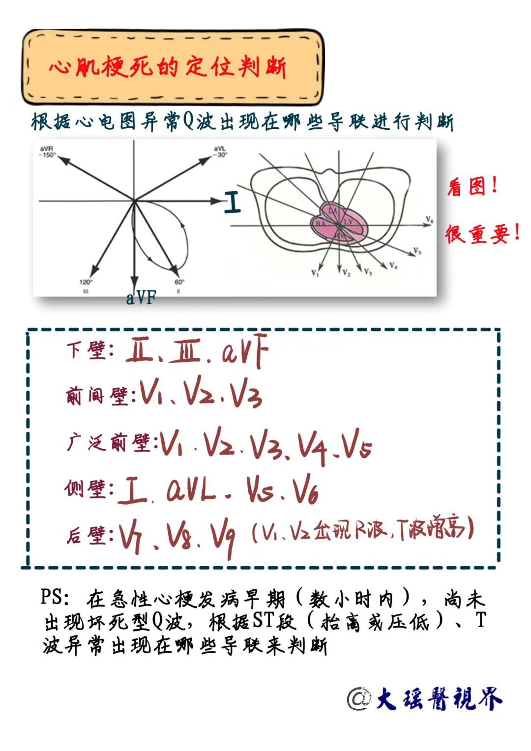 心肌梗死心电图定位 诊断学学习!