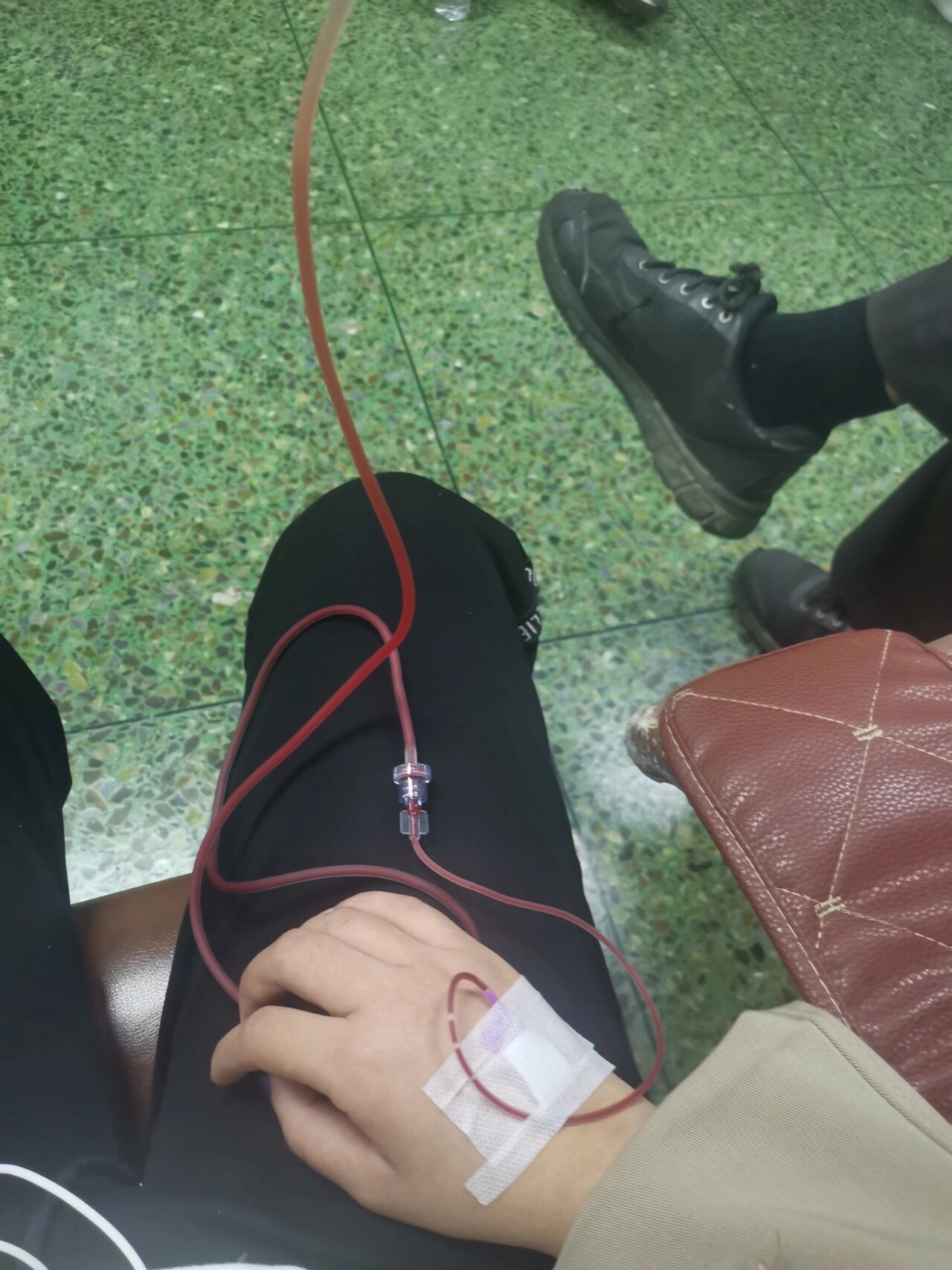 极限回血. 输液的时候上个厕所就这样了