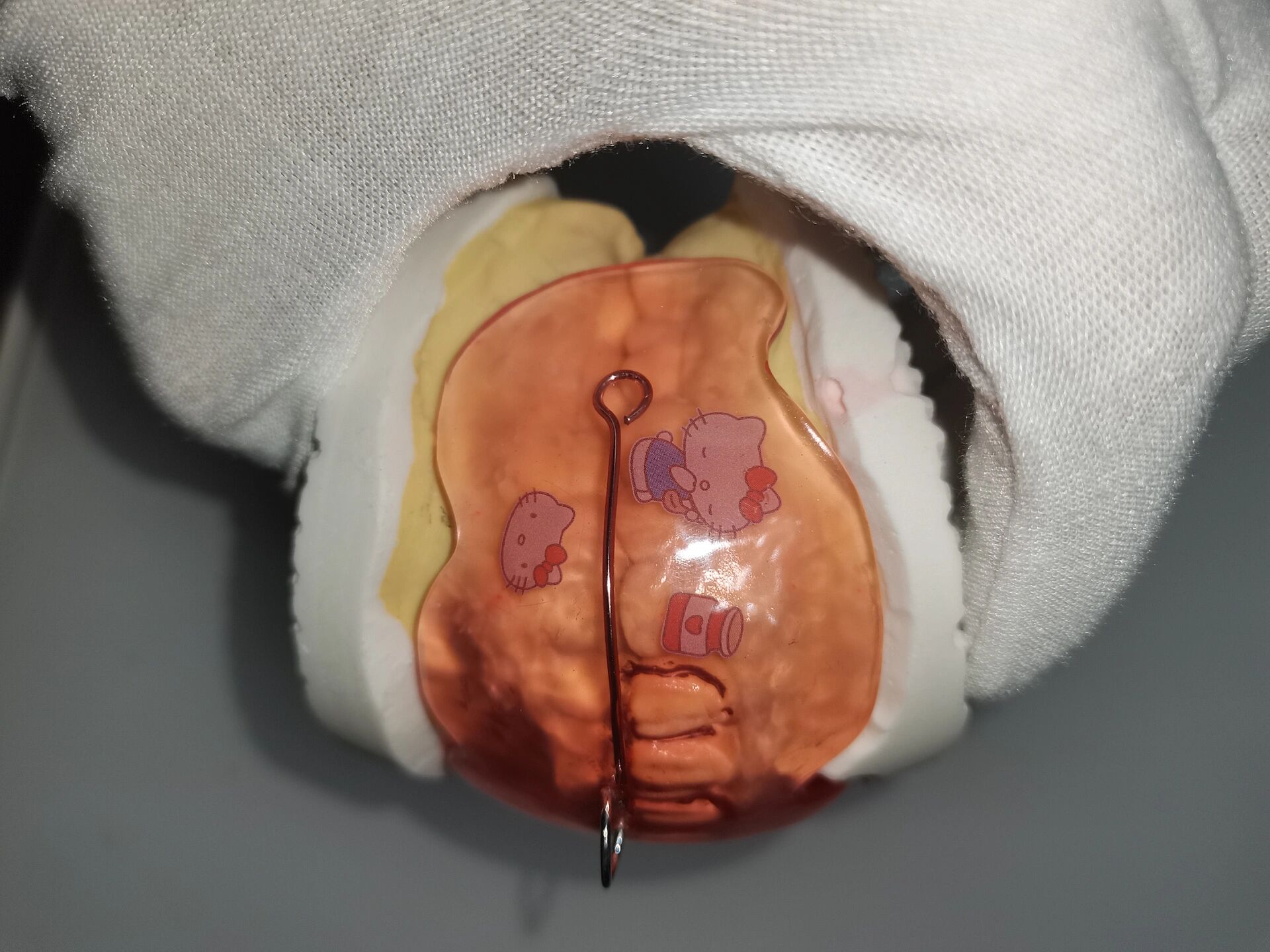 【不良习惯系列】前庭盾矫治器6015 前庭盾可用于破除口呼吸,咬唇
