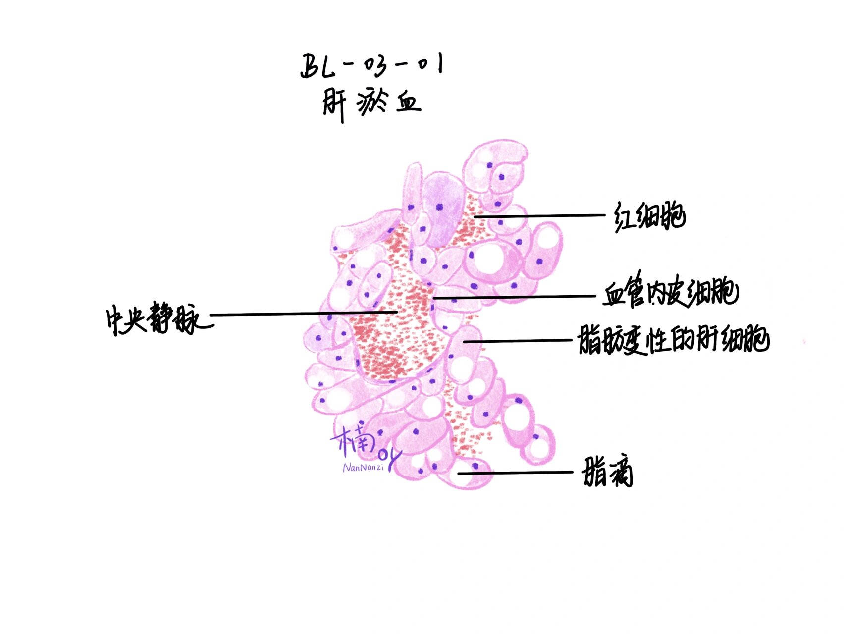 肝淤血图片绘图图片