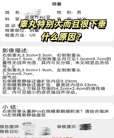 为什么睾丸一边大一边小影响生育吗为什么在线